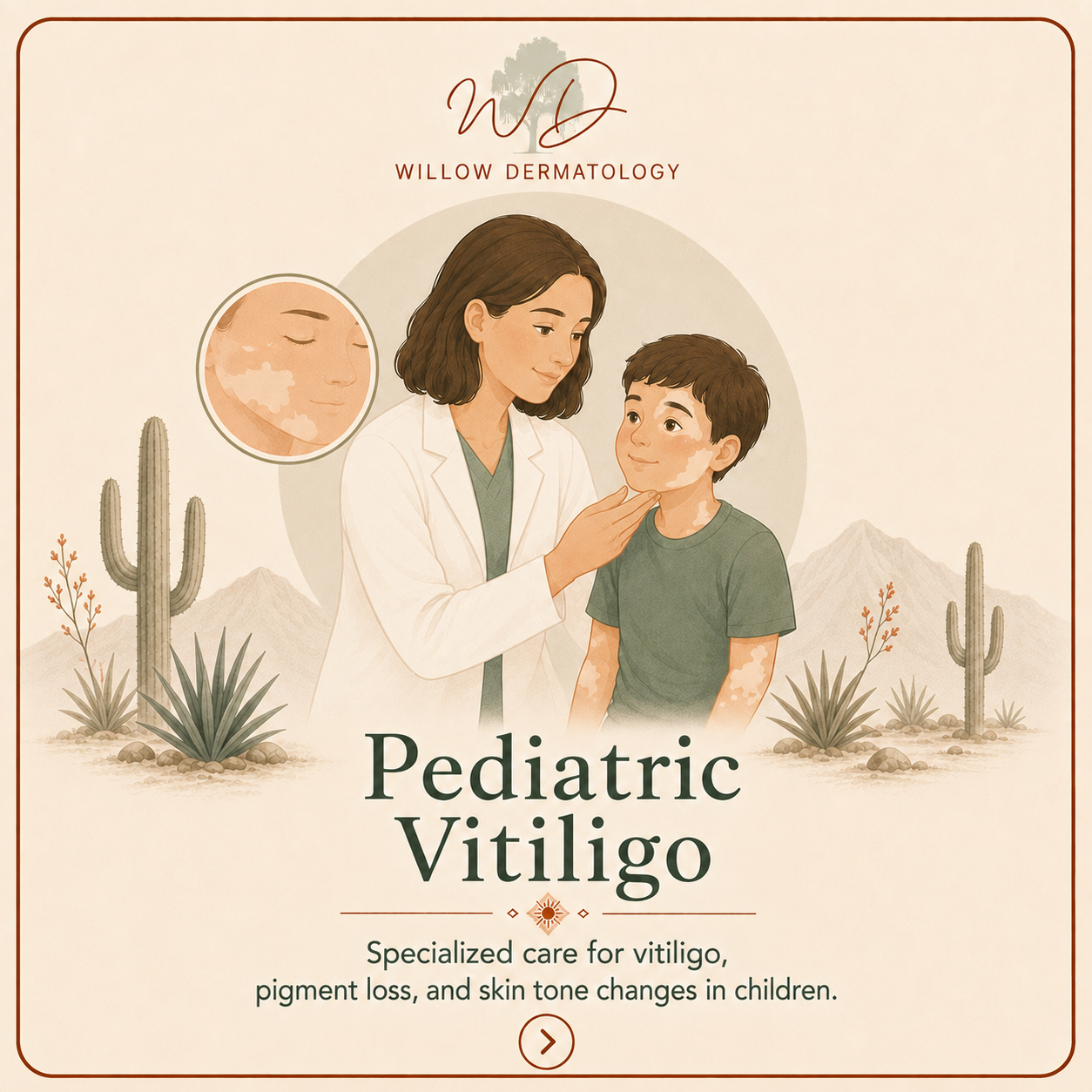 Illustration of a woman pediatric dermatologist examining a young boy with vitiligo, desert landscape with cacti and mountains, and text promoting specialized care for vitiligo in children.