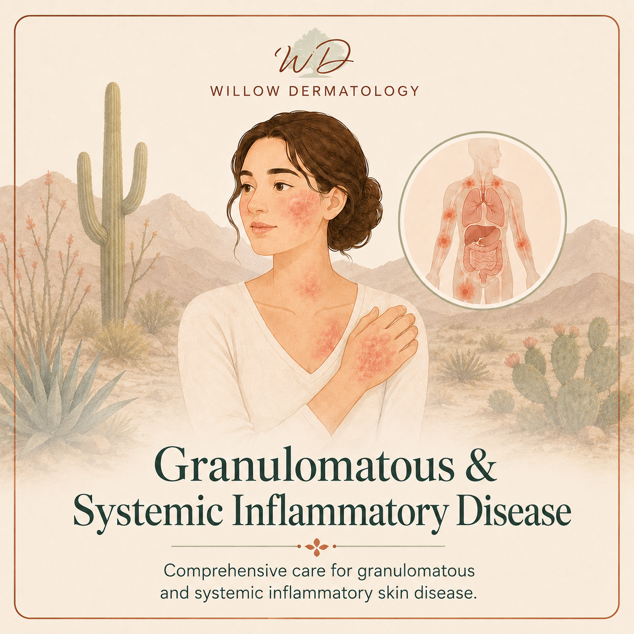 Illustration of a woman with skin inflammation on her face, neck, and hand, representing granulomatous and systemic inflammatory skin disease. A desert landscape with cacti and mountains is in the background, with an inset showing the human body's internal organs affected by inflammation.