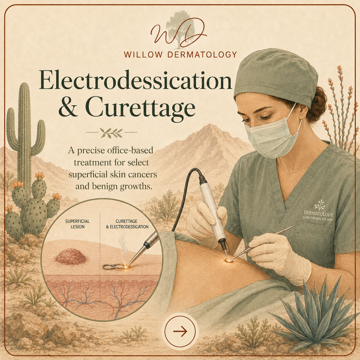 Illustration of a dermatologist performing electrodissection and curettage on a patient's skin, with a desert landscape background and a close-up schematic of the procedure showing superficial lesion removal.