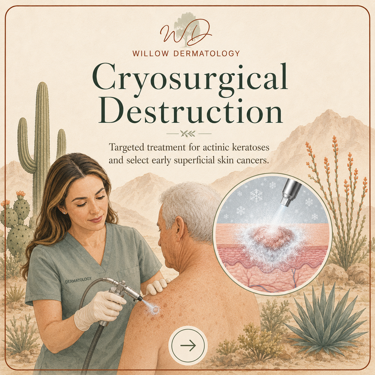 Illustration of a dermatologist performing cryosurgical treatment on a male patient’s shoulder in a desert landscape with cacti and mountains, showing the procedure targeting skin lesions.
