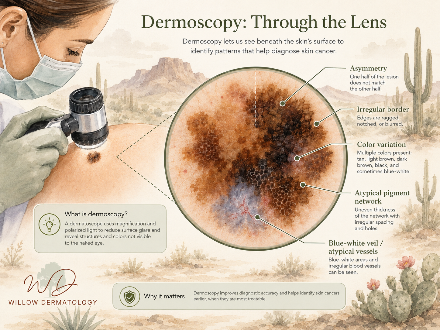 An infographic showing how dermoscopy helps diagnose skin cancer with a close-up of a mole on a person's shoulder being examined using a dermatoscope. The infographic details features like asymmetry, border irregularity, color variation, atypical pigment network, and blue-white veil, with desert landscape background and cacti.
