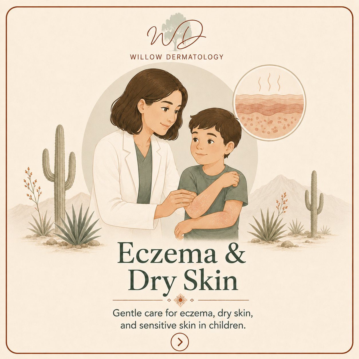 Illustration of a female dermatologist talking to a young boy with eczema on his arms, with desert plants and mountains in the background. The top right corner shows a diagram of dry, irritated skin.