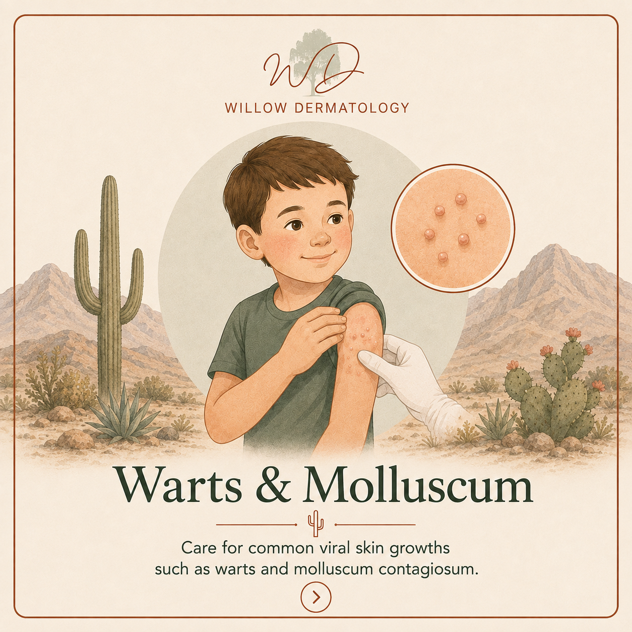 An illustration of a young boy with Warts on his arm, receiving a vaccination. The background features desert landscape with cacti and mountains, and a close-up of virus particles causing warts and molluscum contagiosum.