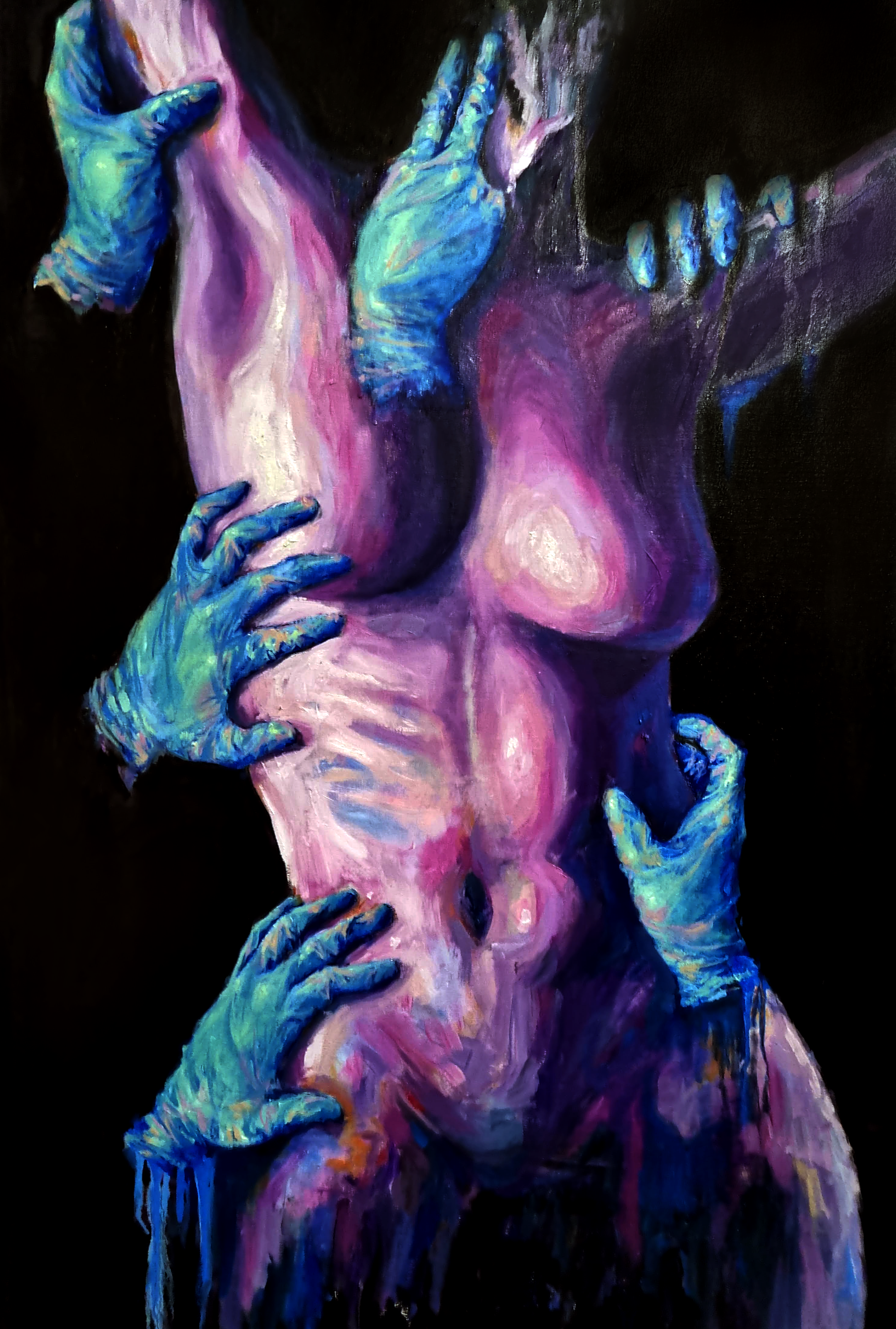 Seizure