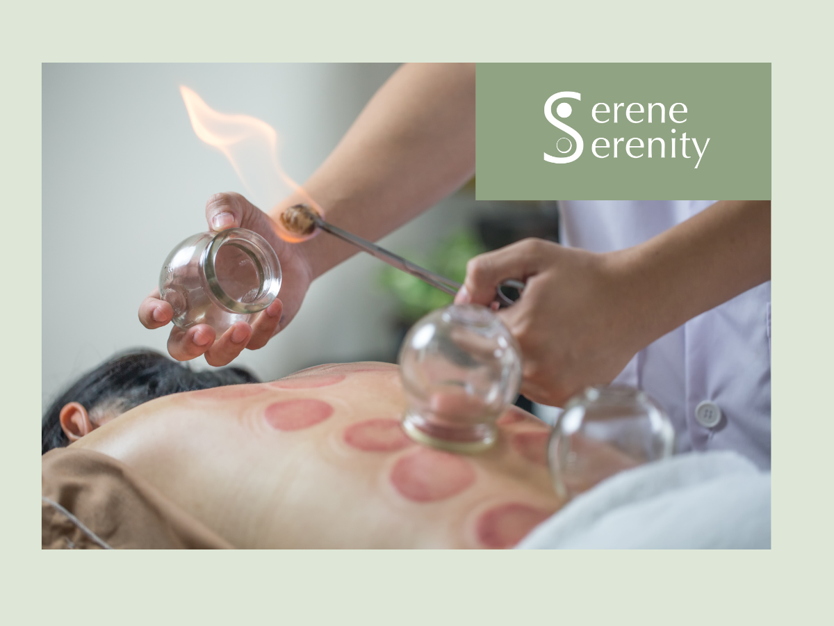 A person receiving cupping therapy on their back, with glass cups placed on the skin and flames used to create suction, during a session at Serene Serenity.