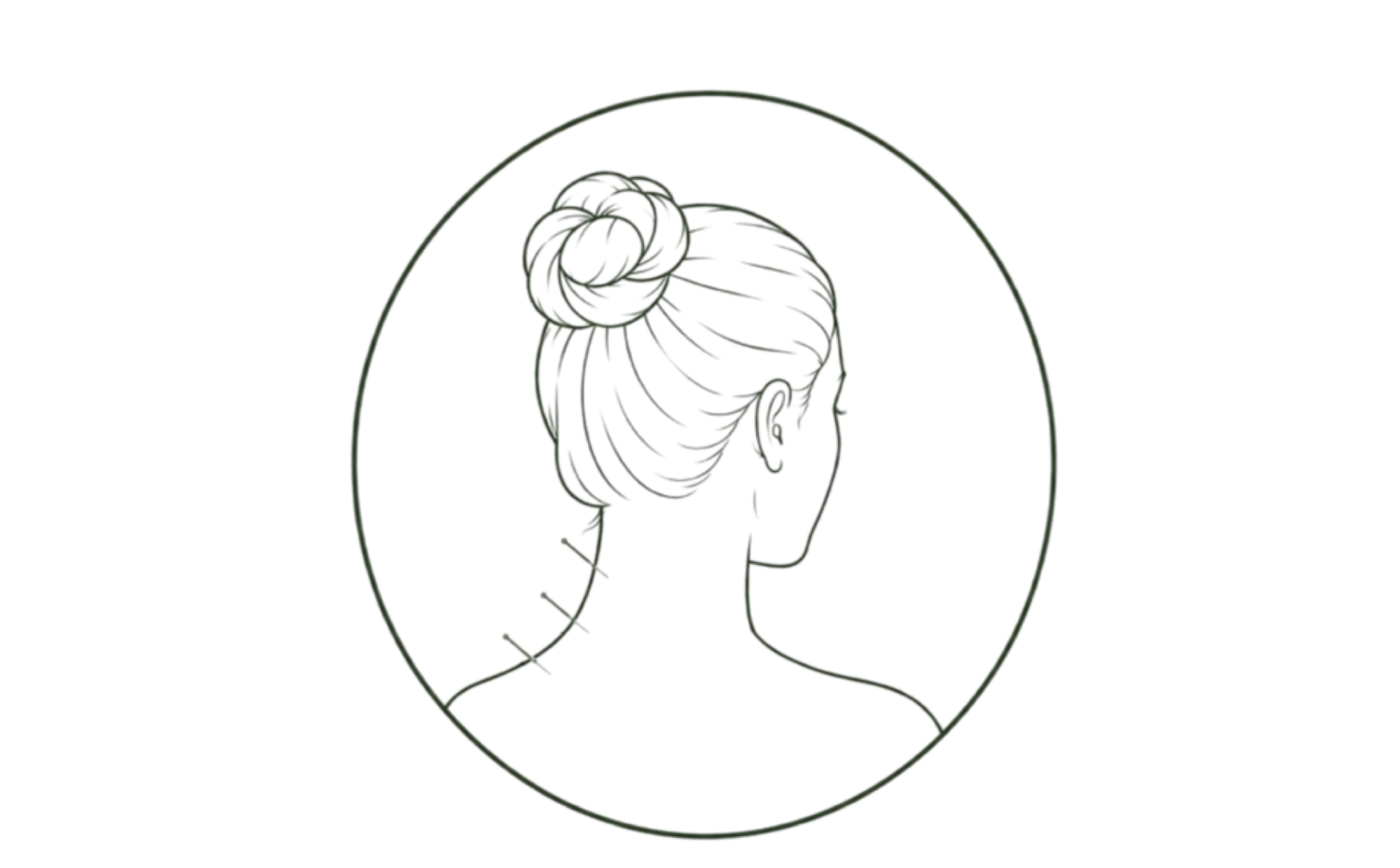 Pain Relief Acupuncture