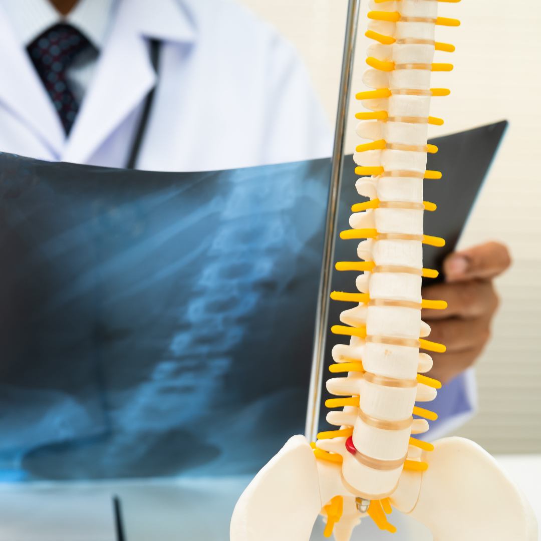 Ergonomic adjustments to reduce back pain, Gautham Prabhakar, spine surgeon in San Antonio, Texas at Texas Neuro Spine