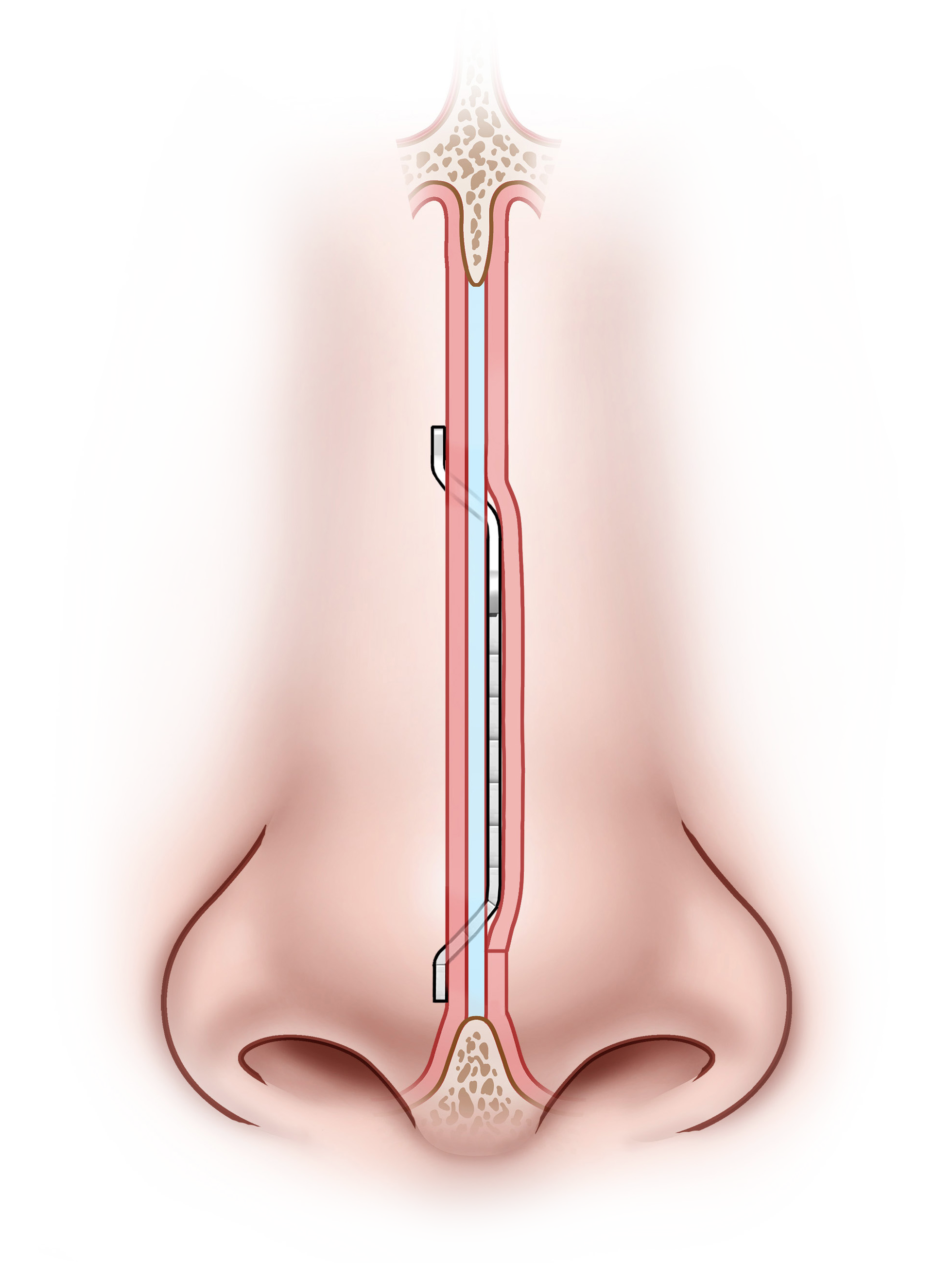 Diagram of the human nose and nasal cavity showing the structure of the nasal passages and sinuses.