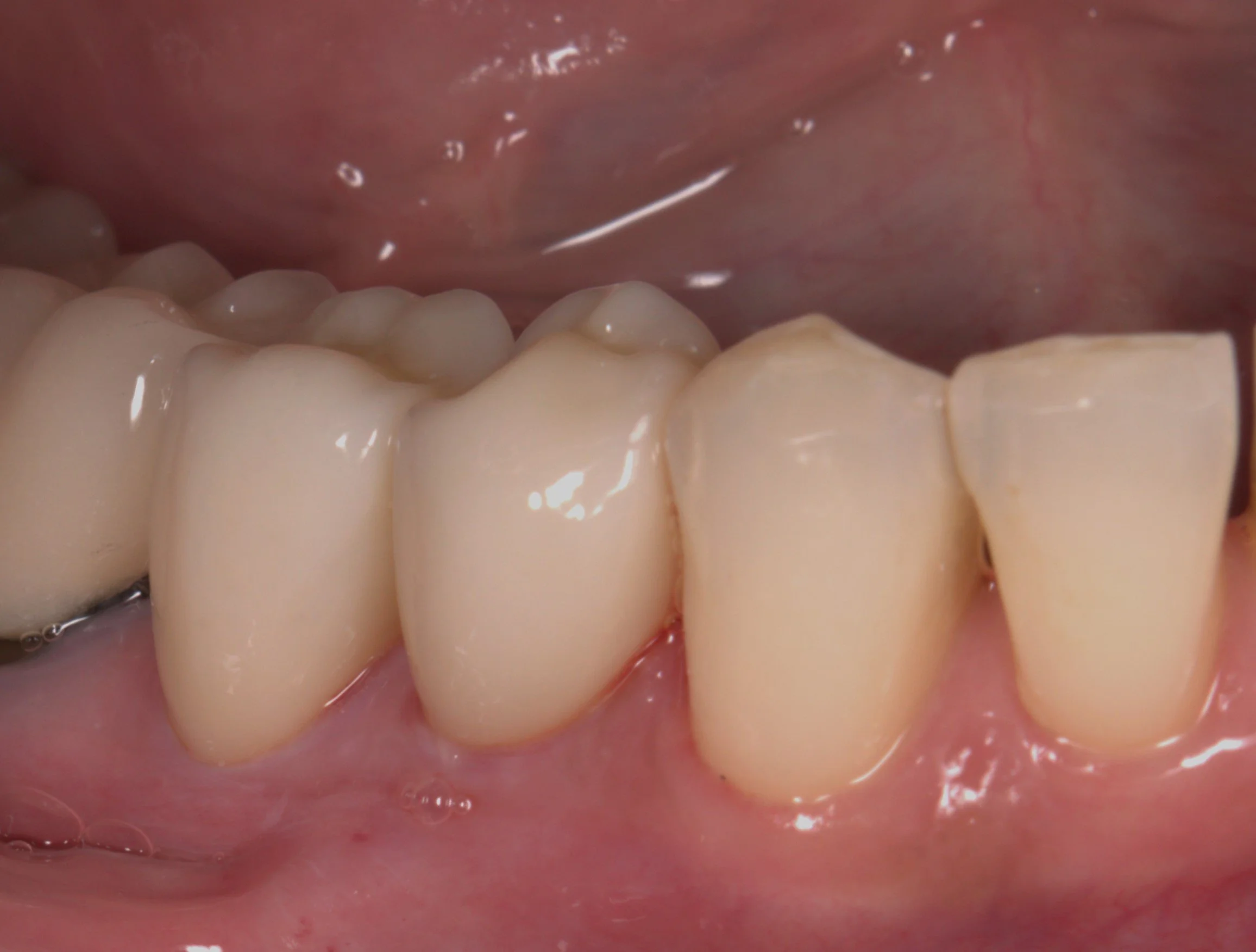 Crown 1.jpg