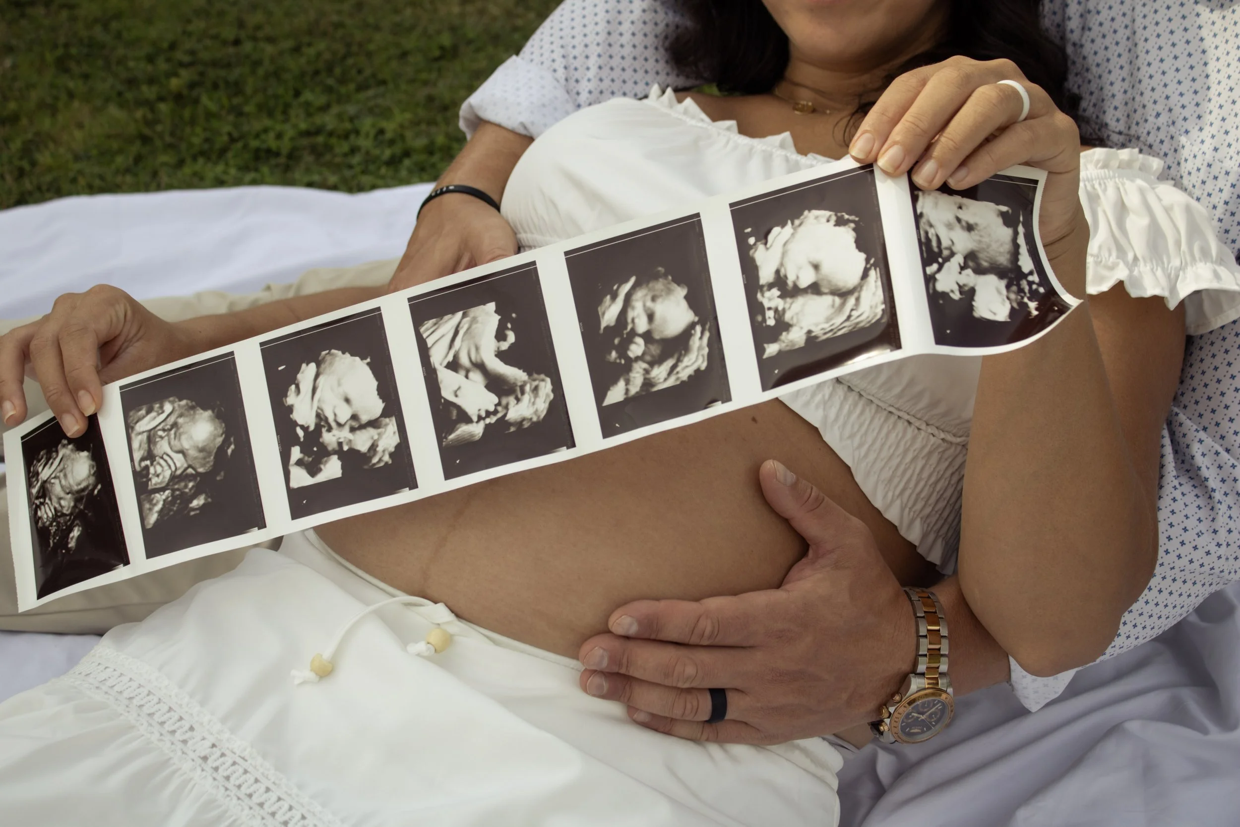 Ultrasound images of a developing fetus being held by a pregnant woman lying on a hospital bed.