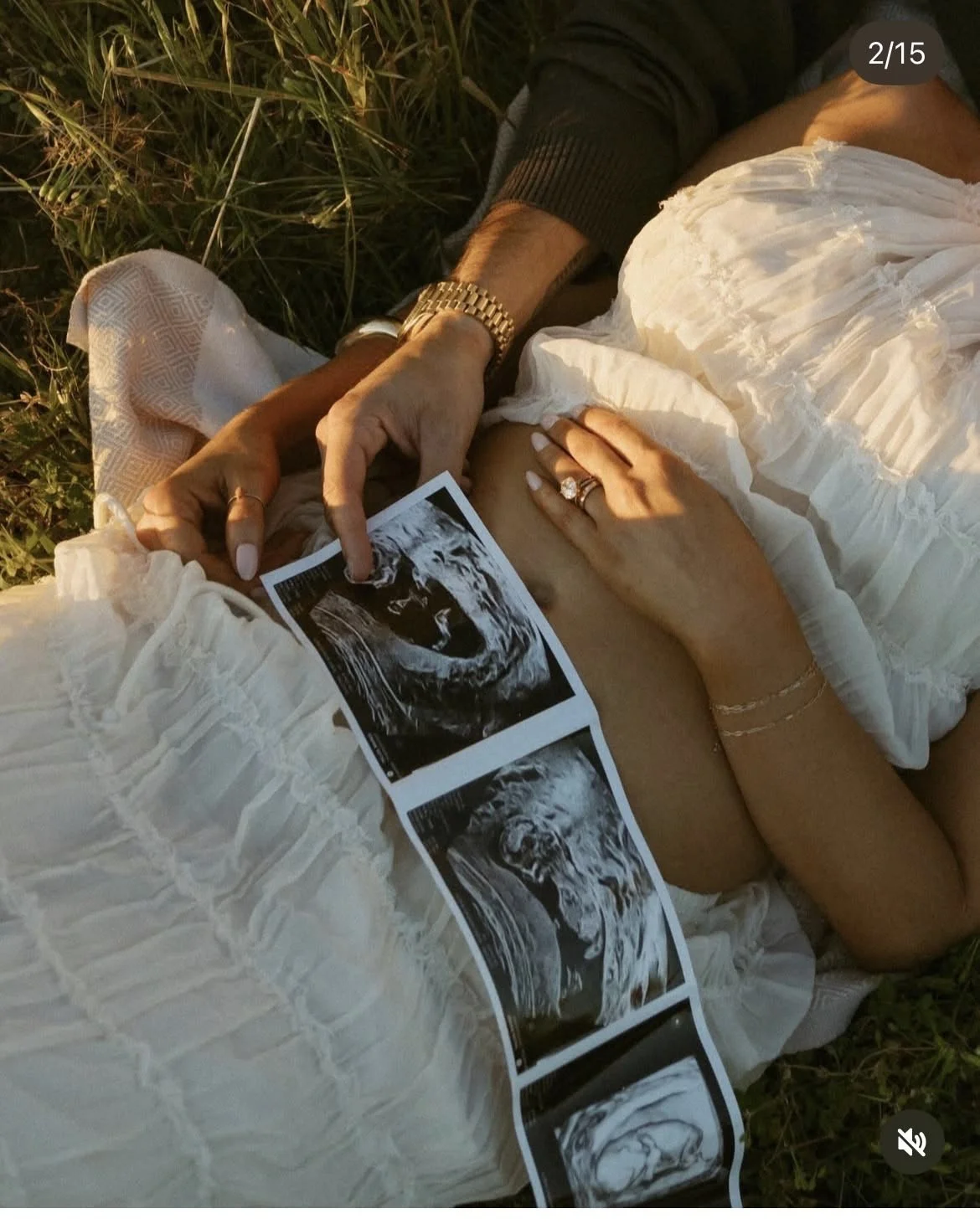 A couple lying outside on grass, holding an ultrasound image, with the woman wearing a white dress and several rings and bracelets.
