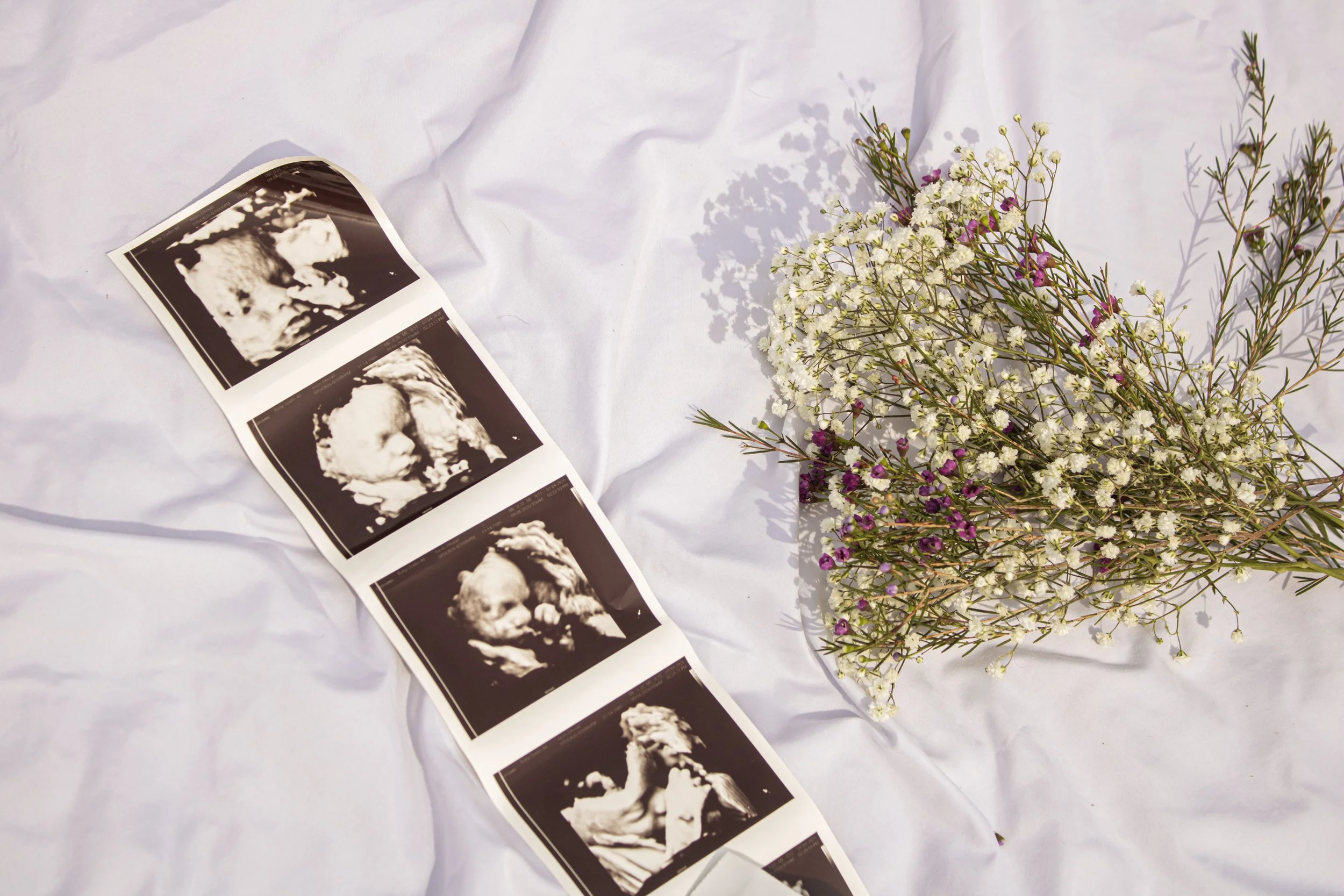 A white background with a printed ultrasound image on a strip of film on the left and a bouquet of white and purple flowers on the right.
