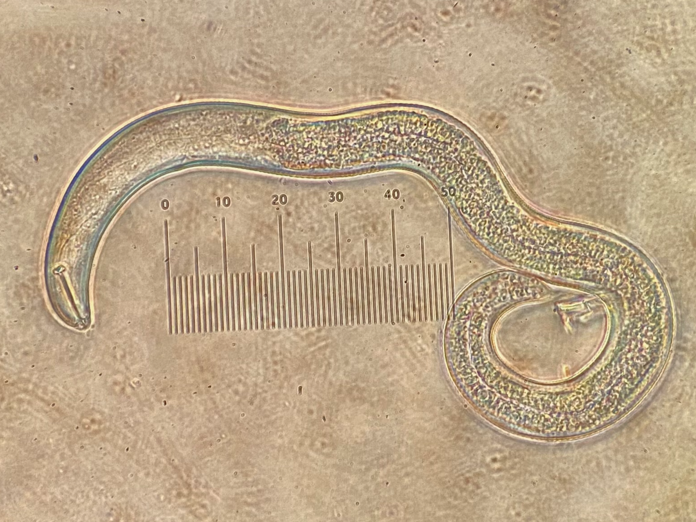 Microscopic image of a nematode worm, with a ruler for scale showing measurements from 0 to 50 micrometers.