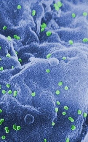 Research shows HIV virus may hide in bone marrow