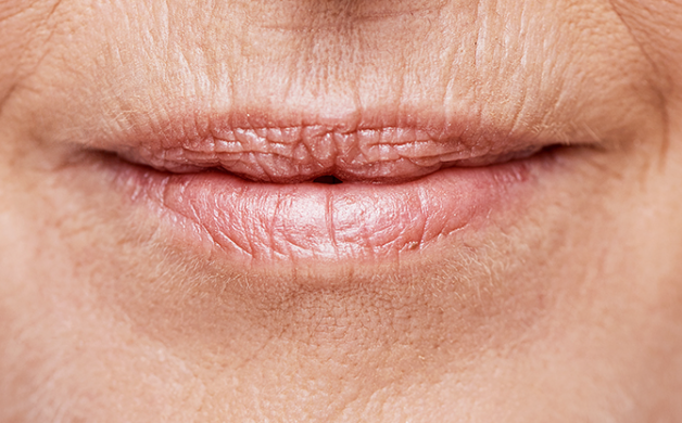 Boca de una persona con labios ligeramente secos y arrugas finas.