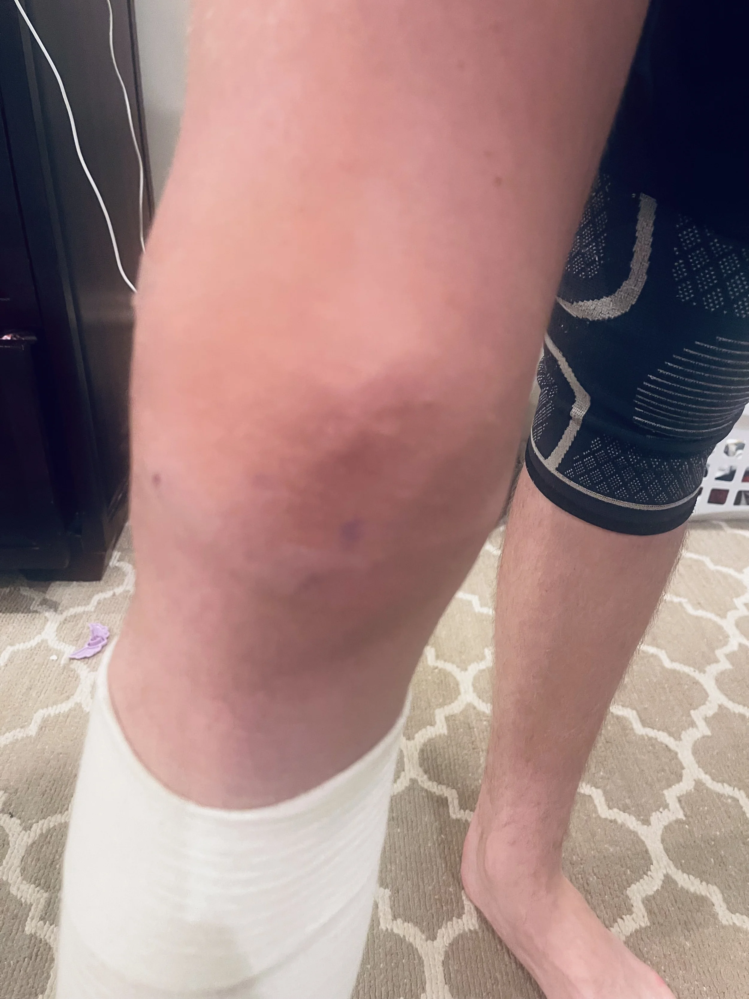 Close-up of a person's arm and leg, with another person's leg visible in the background, on a patterned rug.