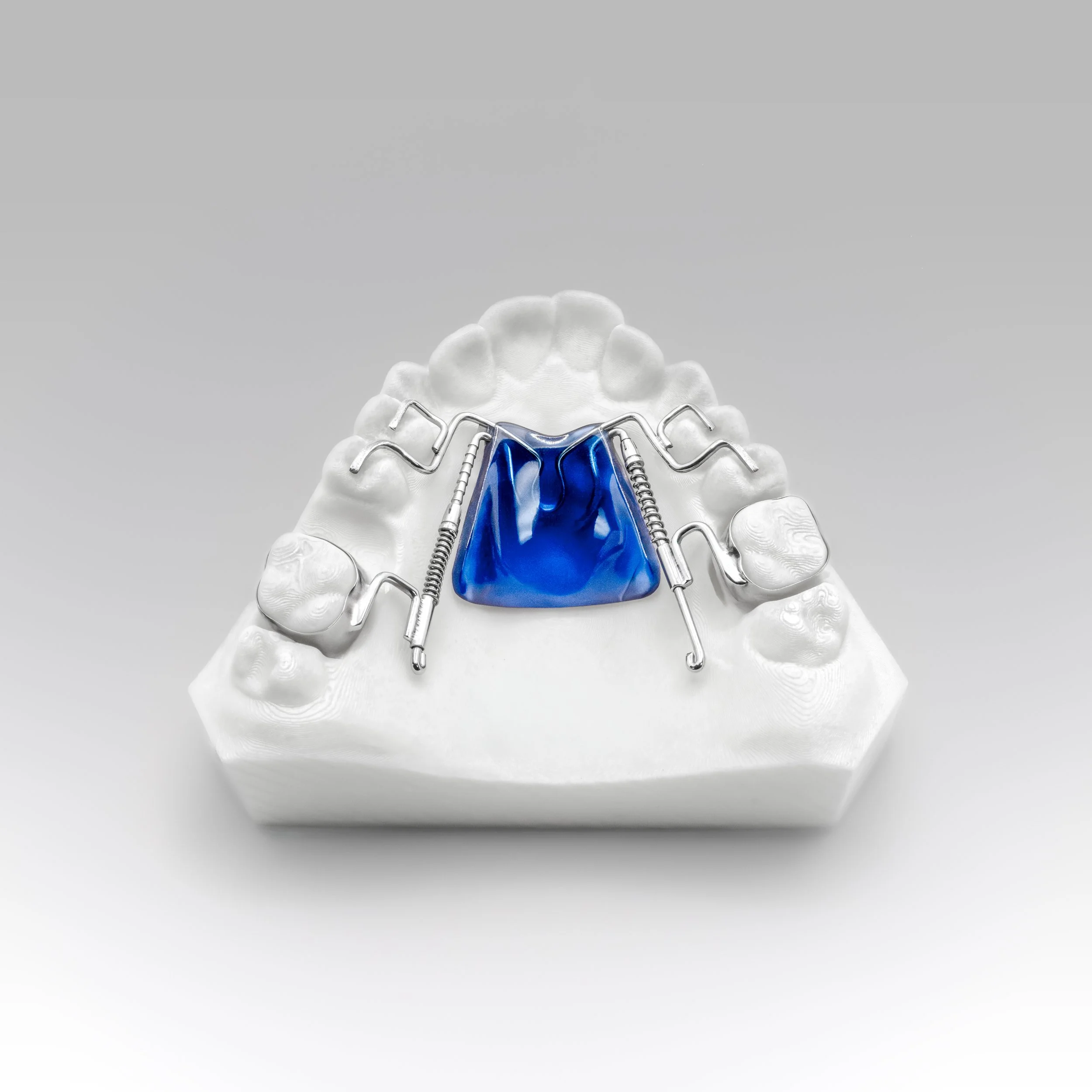 Ipc Distalizer