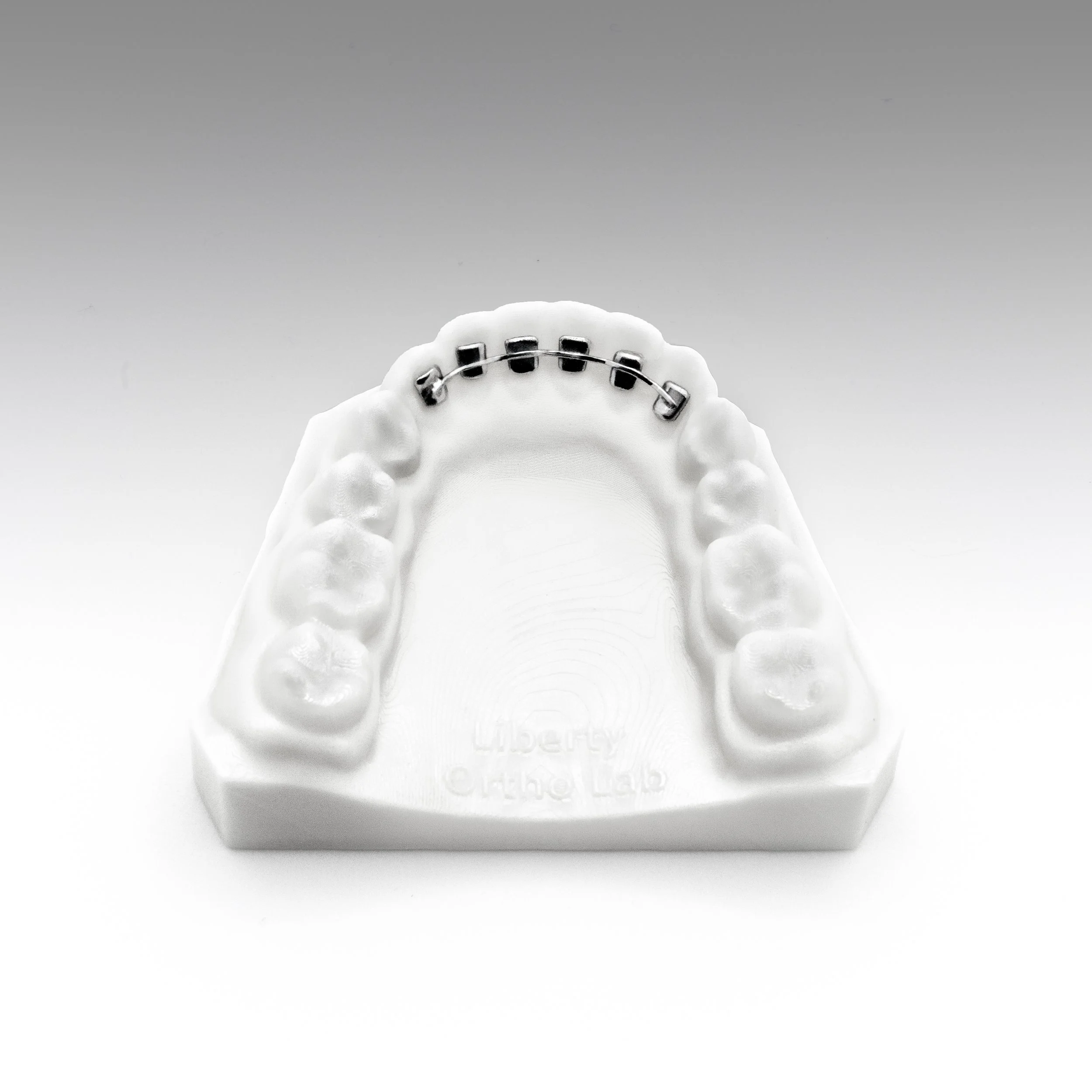 A white dental mold showing the upper teeth with orthodontic braces attached to the front teeth.