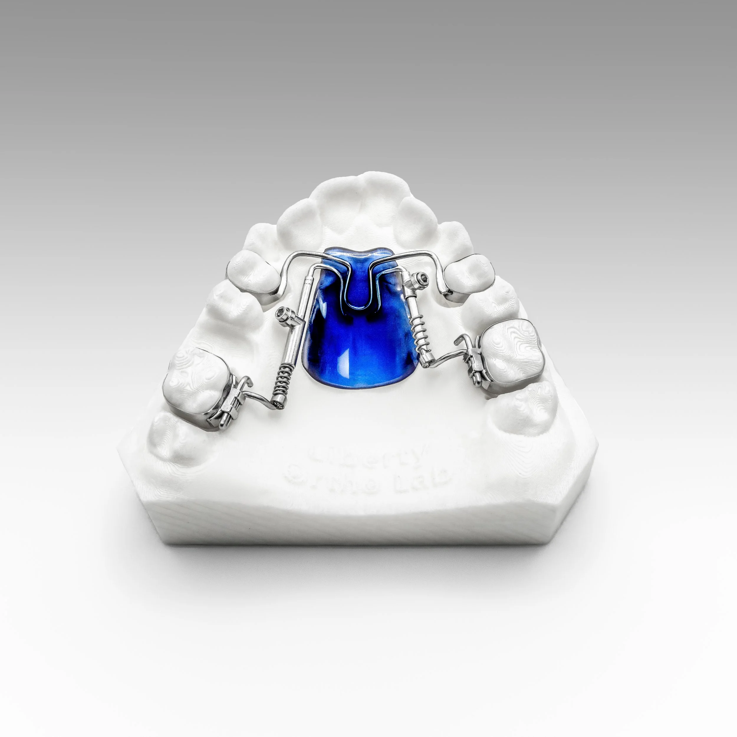 A dental model of a human upper jaw with orthodontic braces attached, including metal wires and brackets, displayed against a plain background.