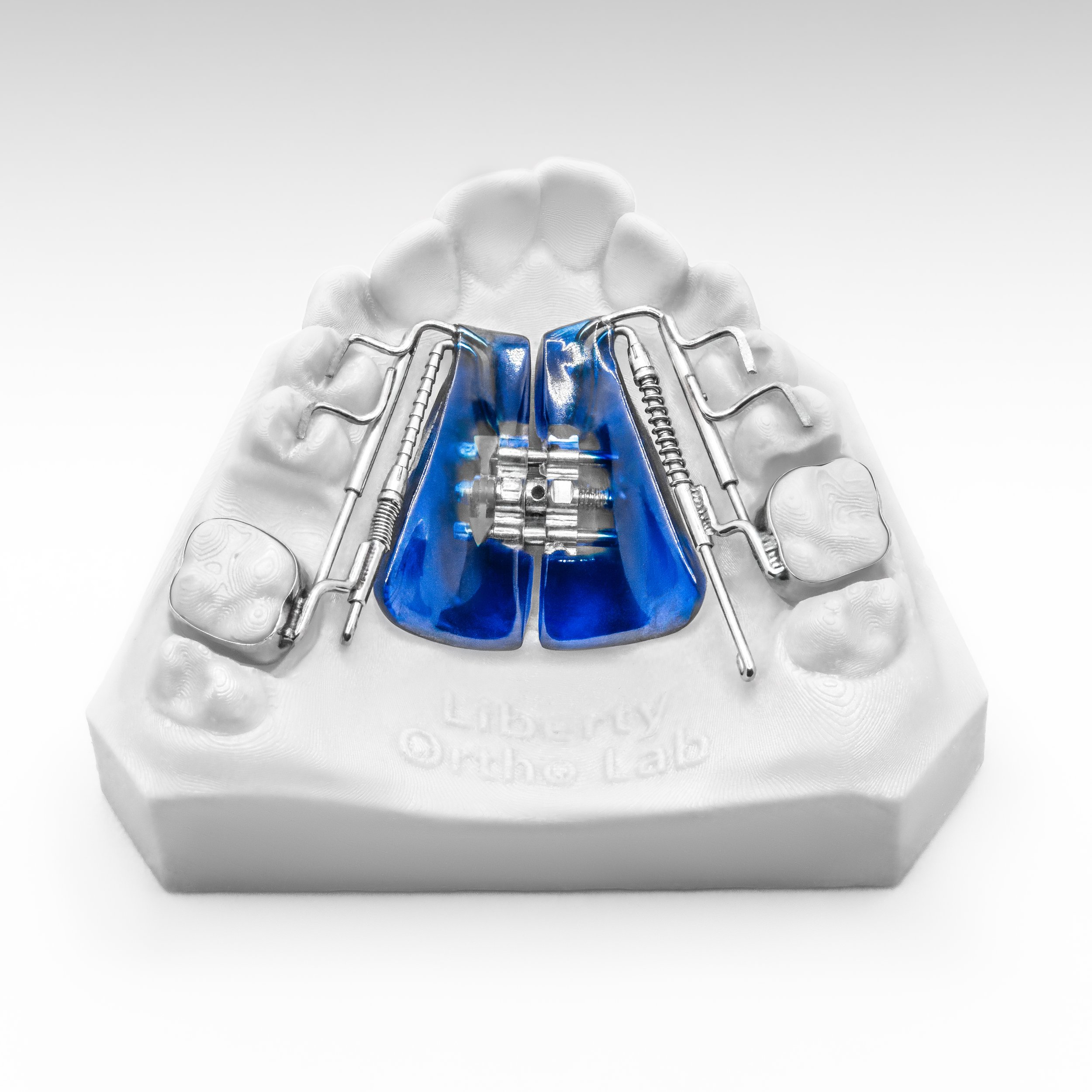 IPC 3 WAY DITALIZER