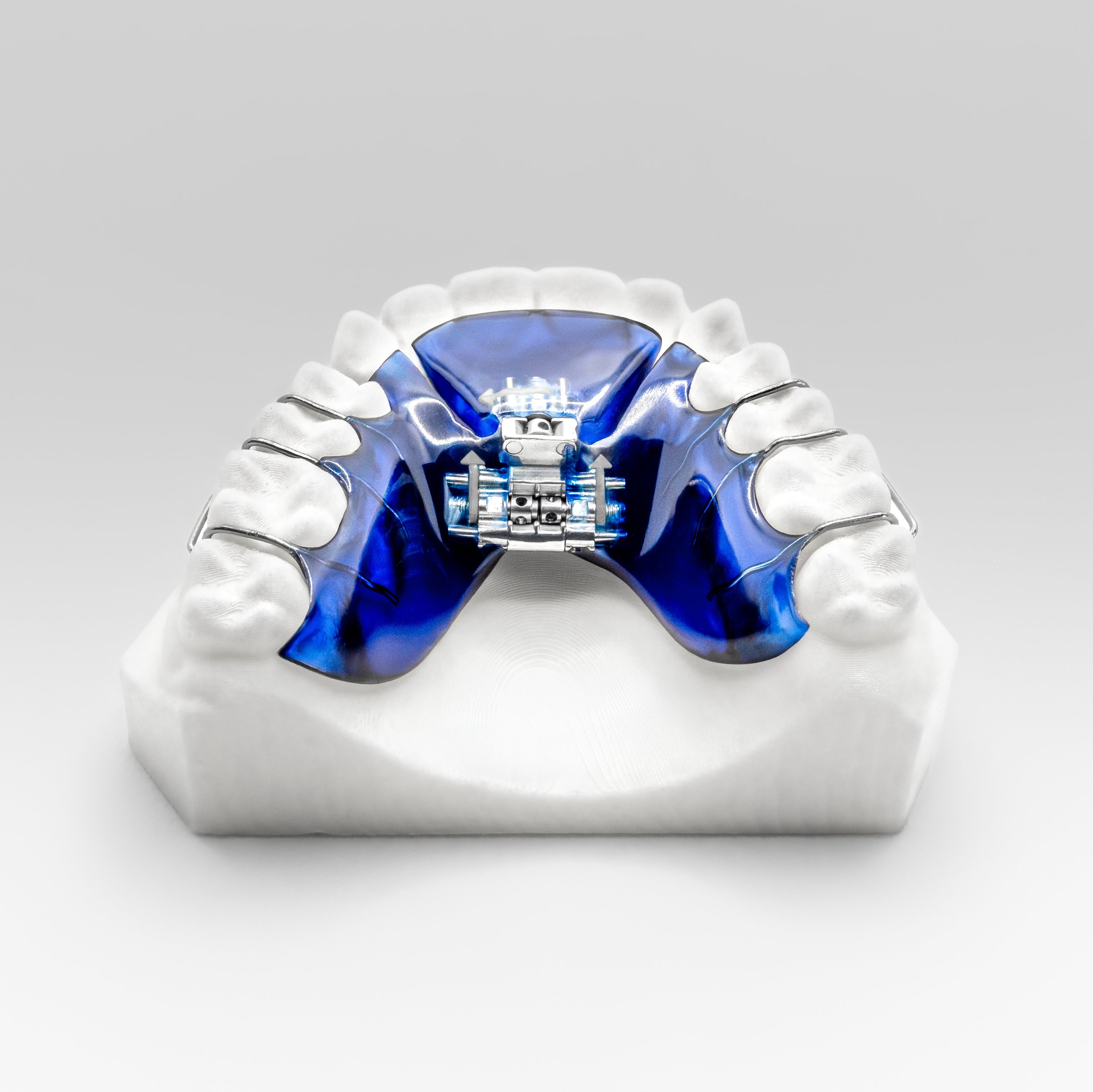 3Way Sagittal