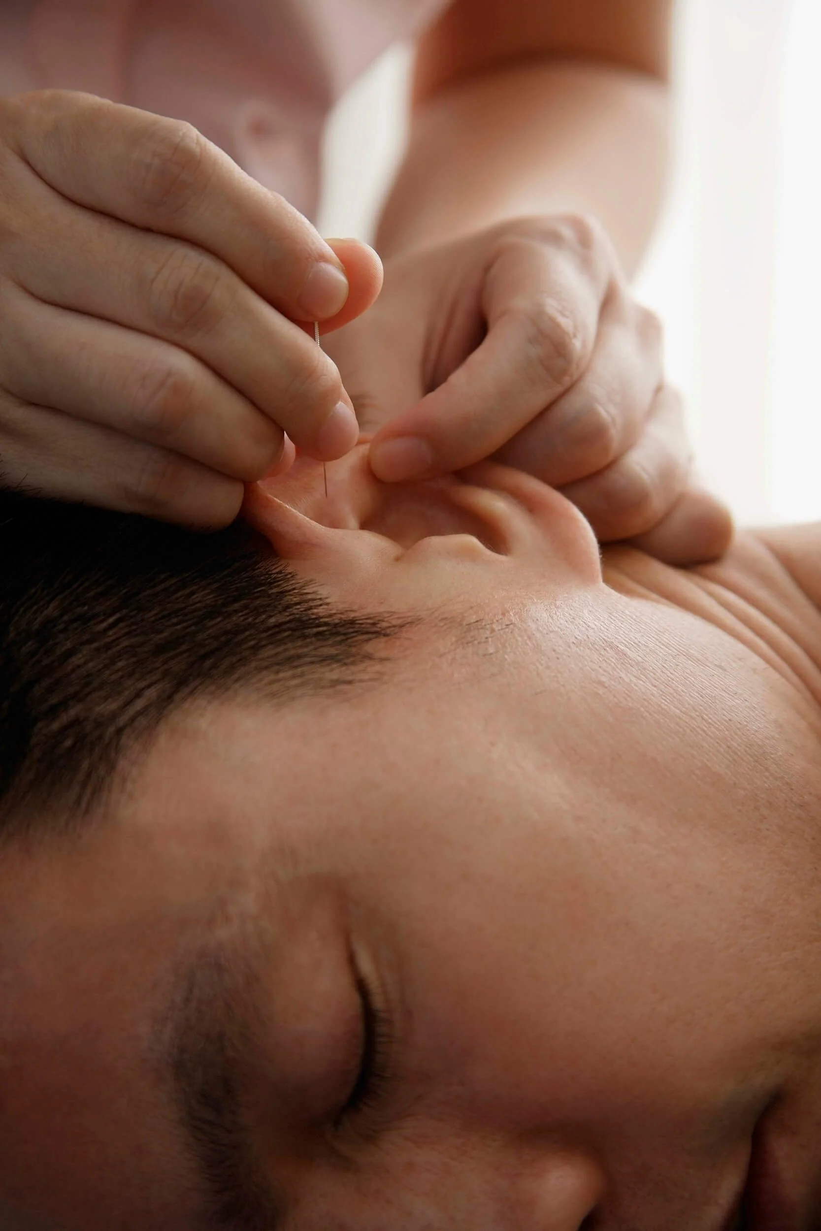 A person receiving ear acupuncture treatment, with a practitioner inserting a thin needle at New Heights Acupuncture and Chinese Medicine in Houston, Texas.