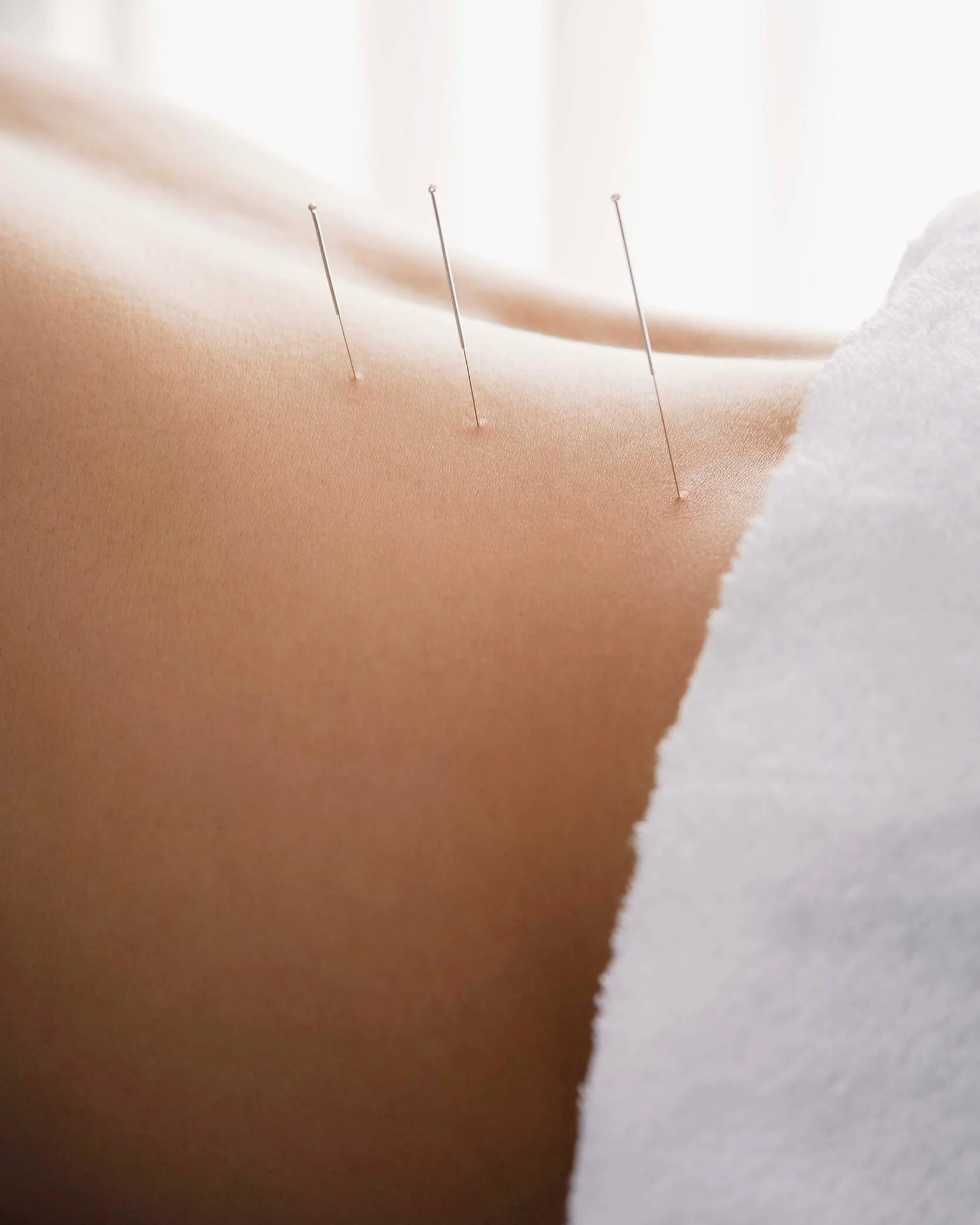 ++new-heights-acupuncture-houston-2-tall.jpg