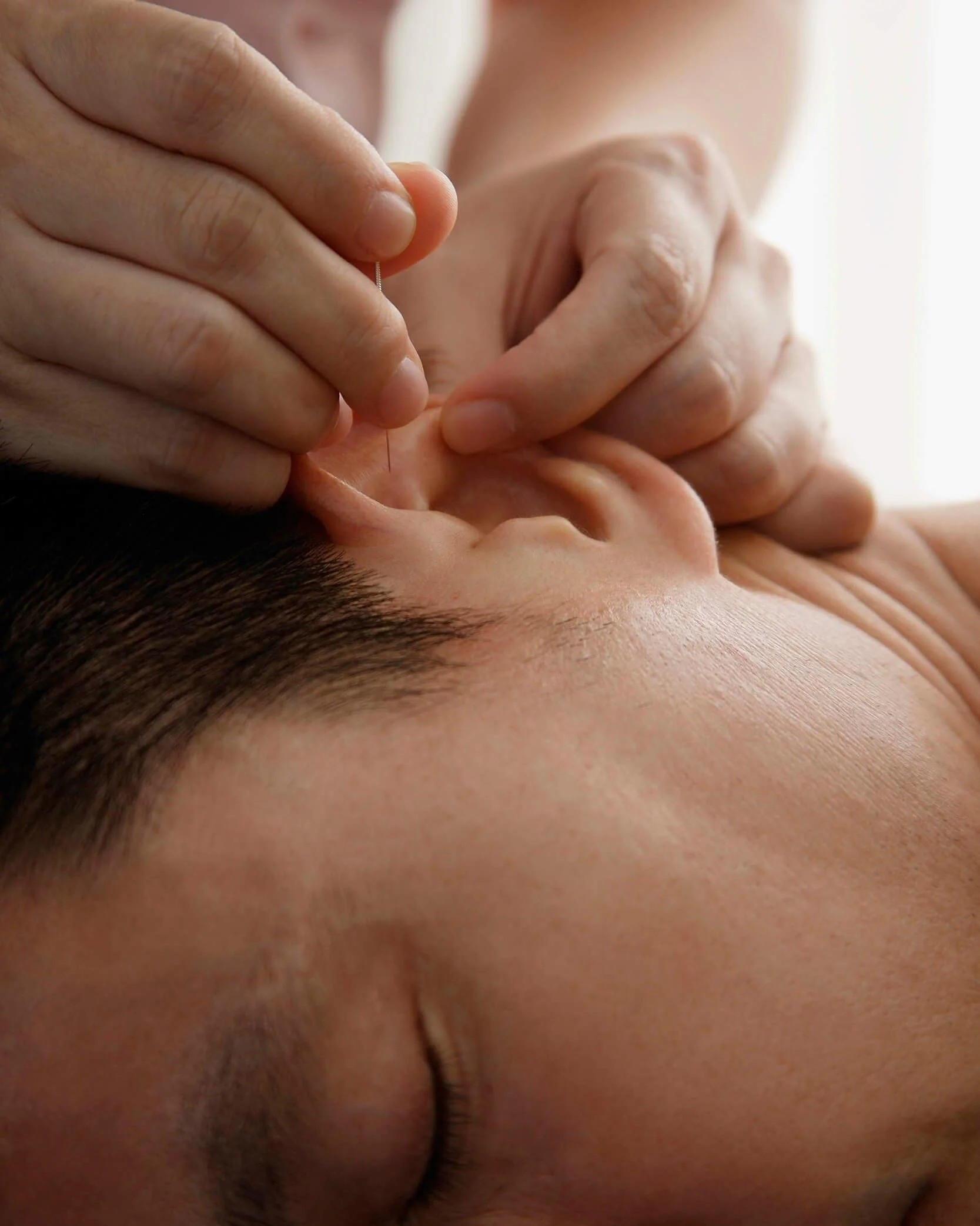+ear-acupuncture-for-stress-tall.jpg