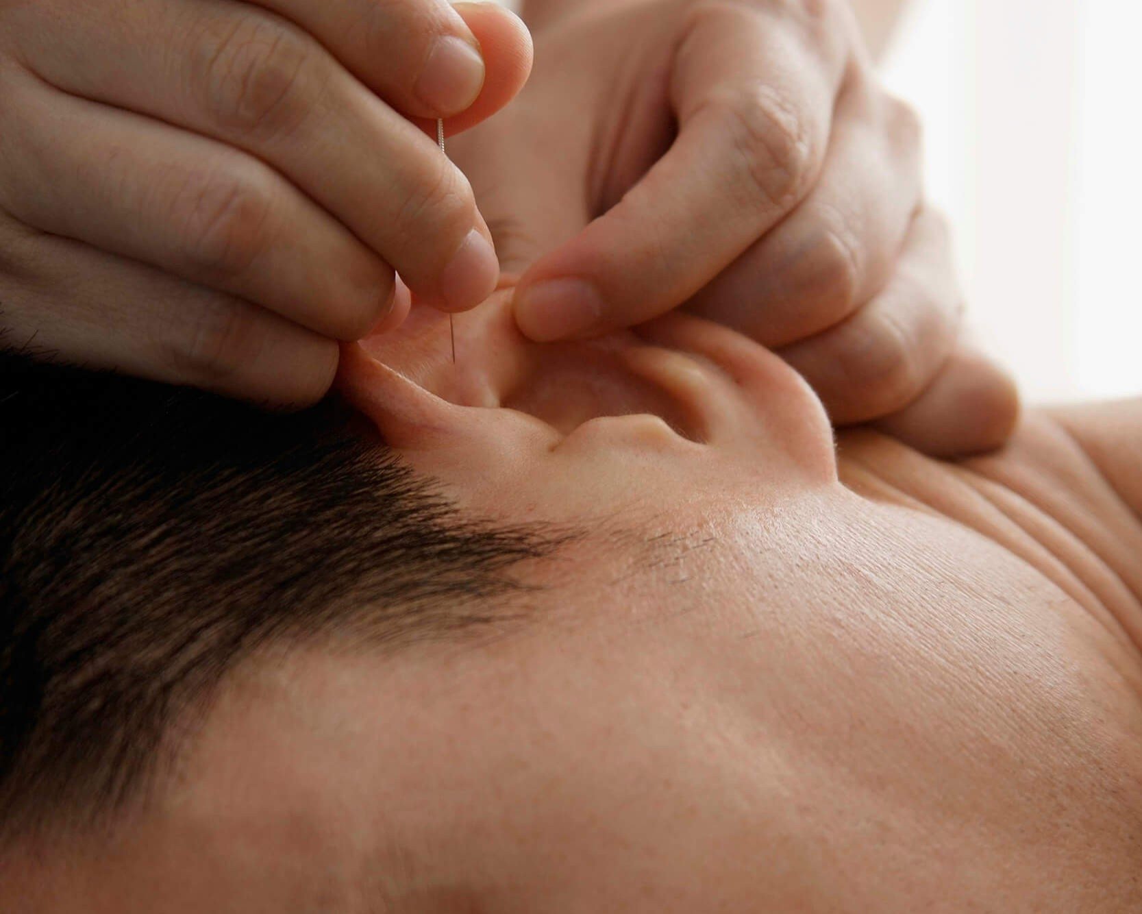+ear-acupuncture-for-stress-wide.jpg