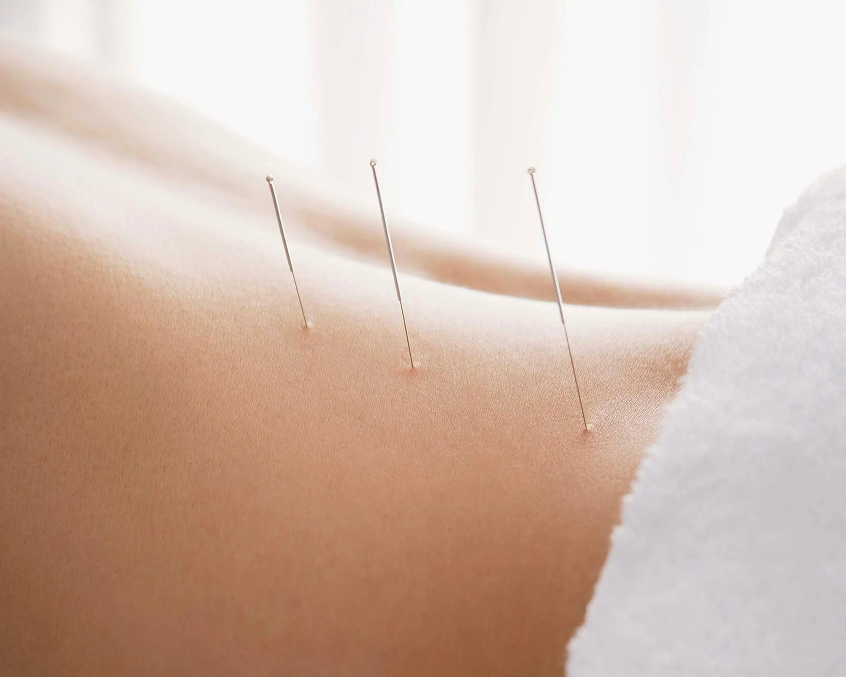 ++new-heights-acupuncture-houston-2-wide.jpg