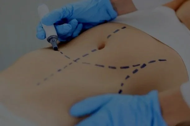 Post-Op Lymphatic Drainage