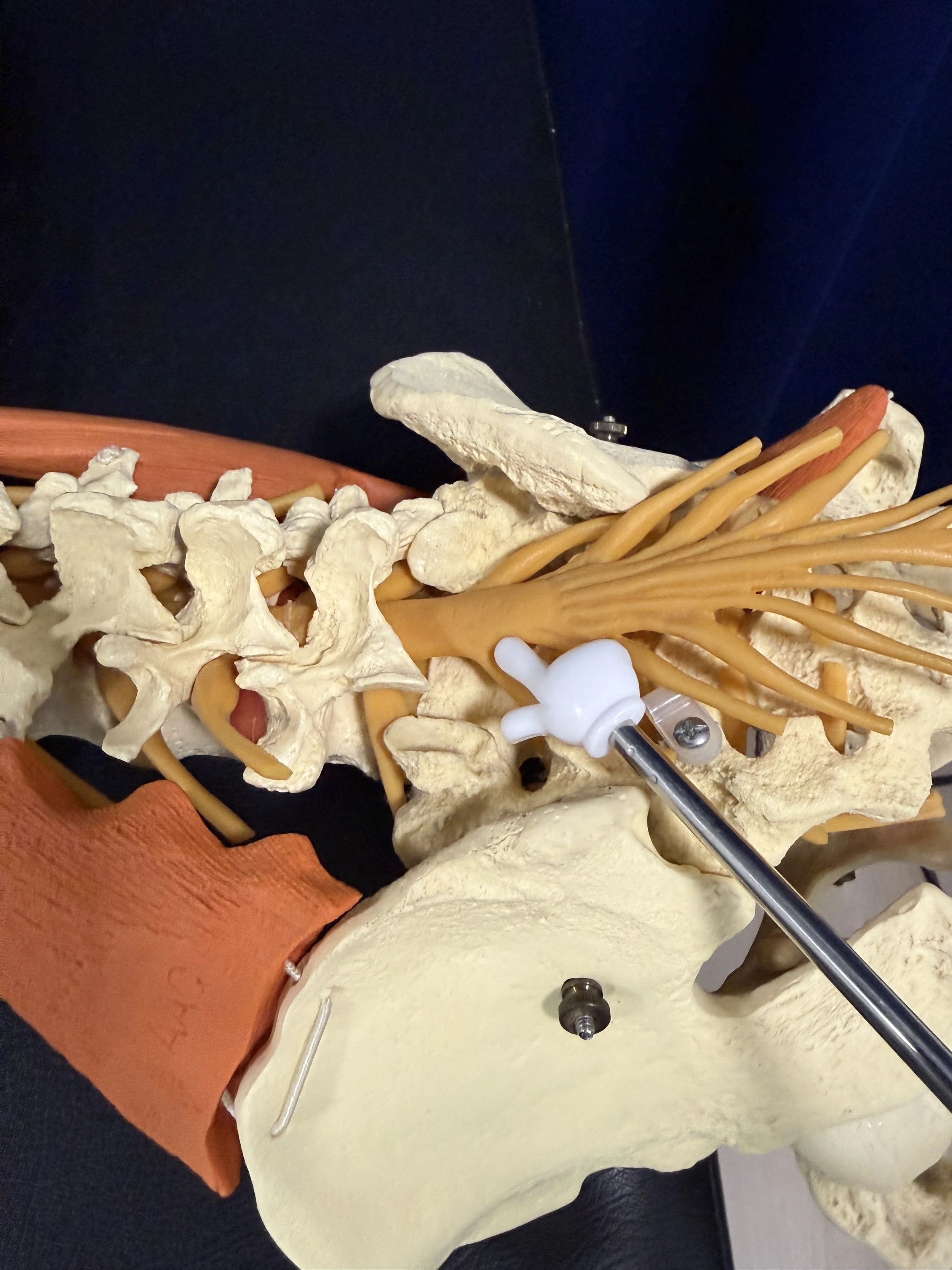 Lumbar spine model demonstrating spinal nerve anatomy at Pacific Northwest
