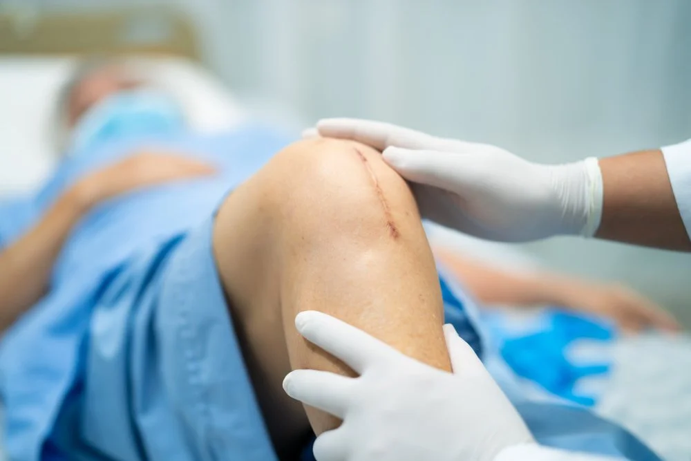 Joint Replacements