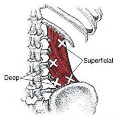 How to Release Trigger Points for Lower Back Pain