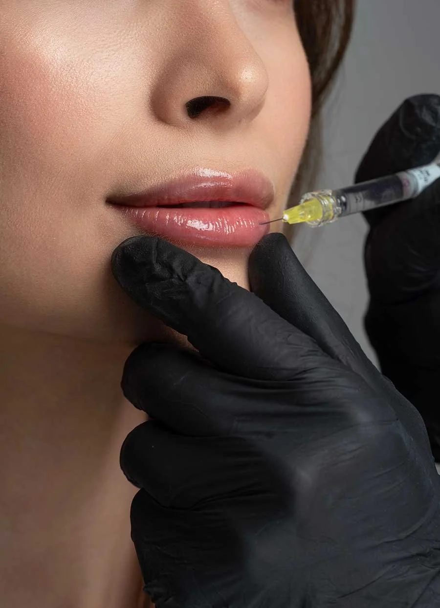 Dermal Filler for Lips, Cheek, Chin, and Jawline by Freyja Aesthetics & Wellness Medspa in Vancouver, WA