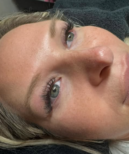 Close-up of a woman's face lying down, showing her eyes, nose, and forehead.