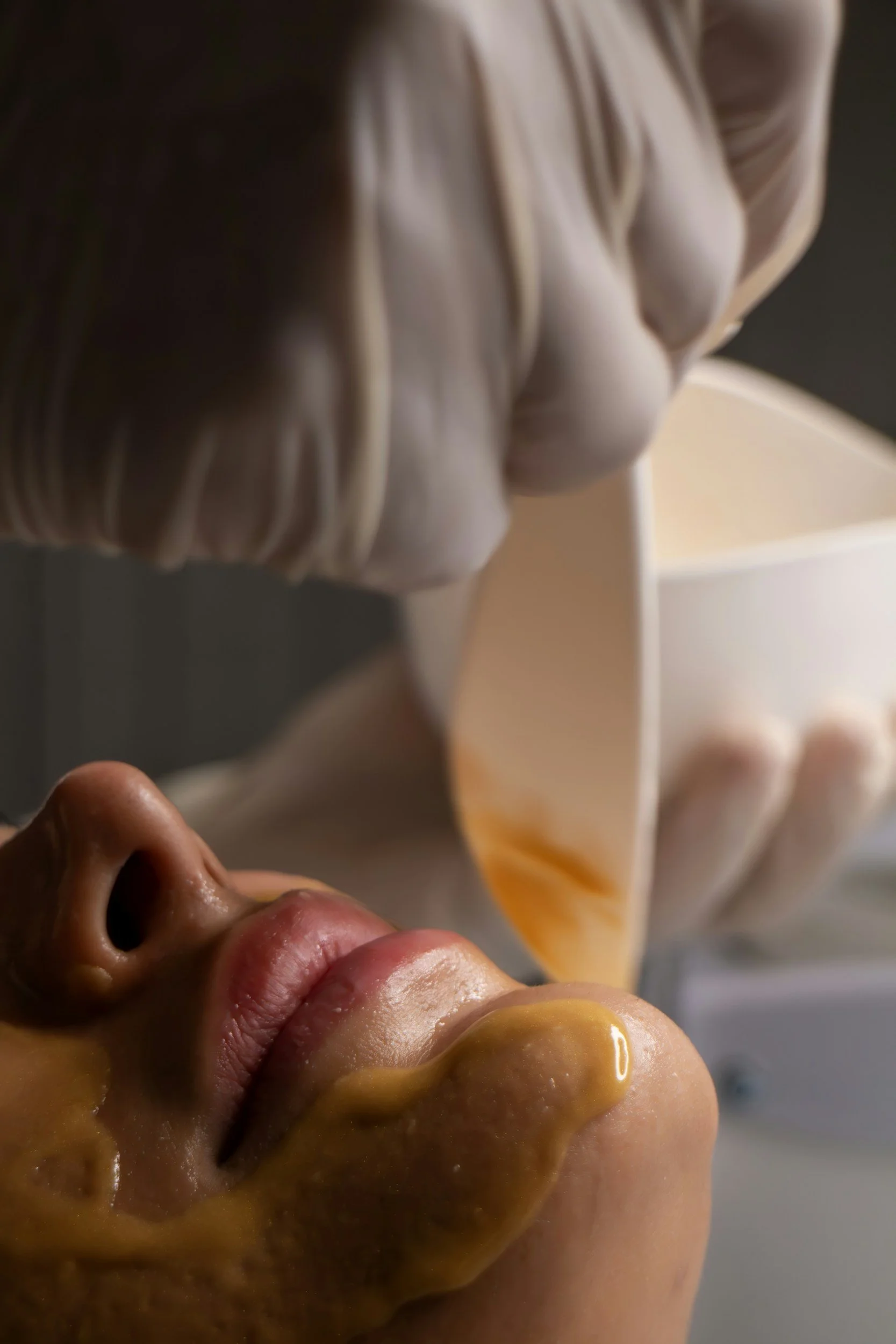 Close-up of a hand holding a bowl of skin care product and a spatula and applying the skin treatment to a patient's face.