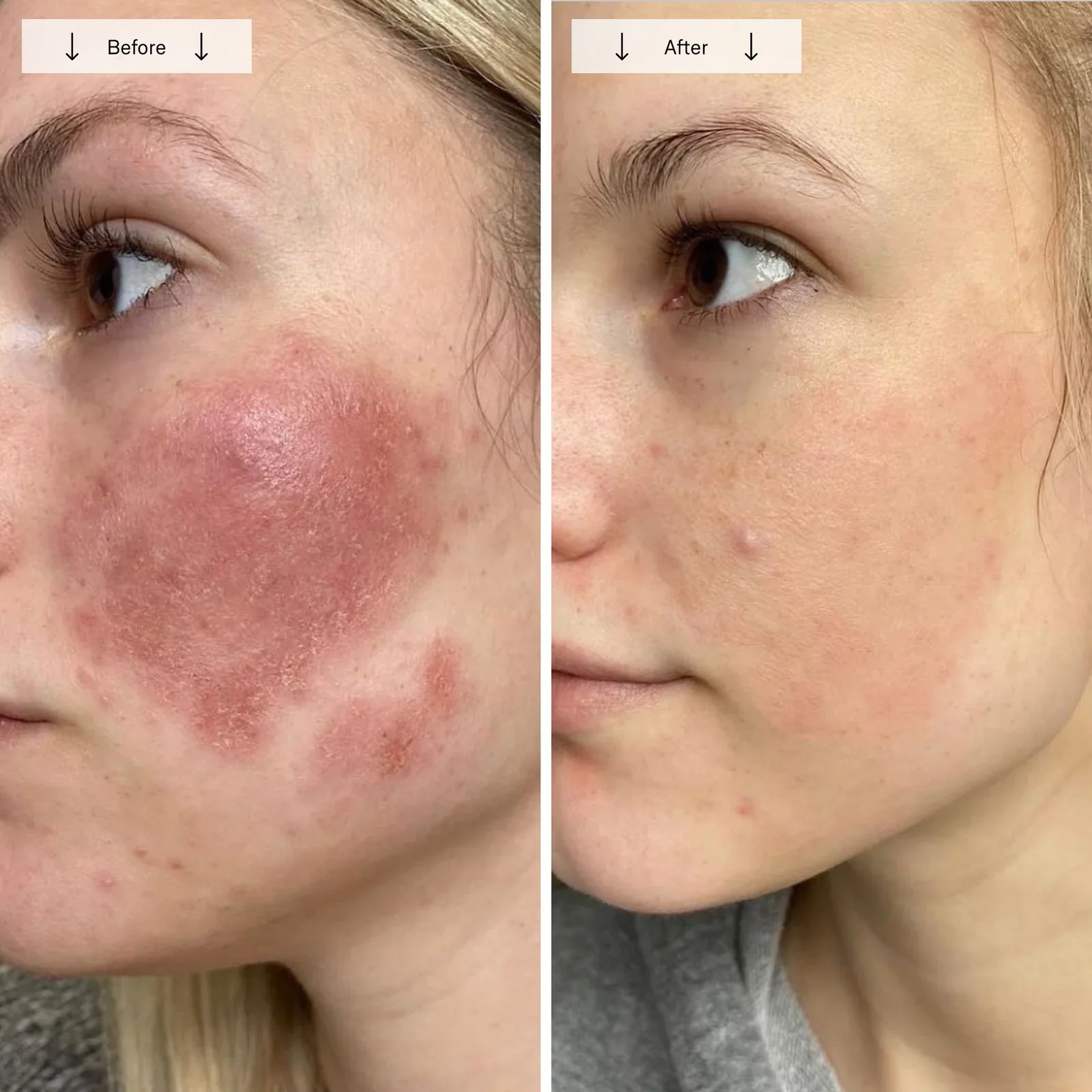 Contour_Face_PDP_Image_12_BA_3.webp