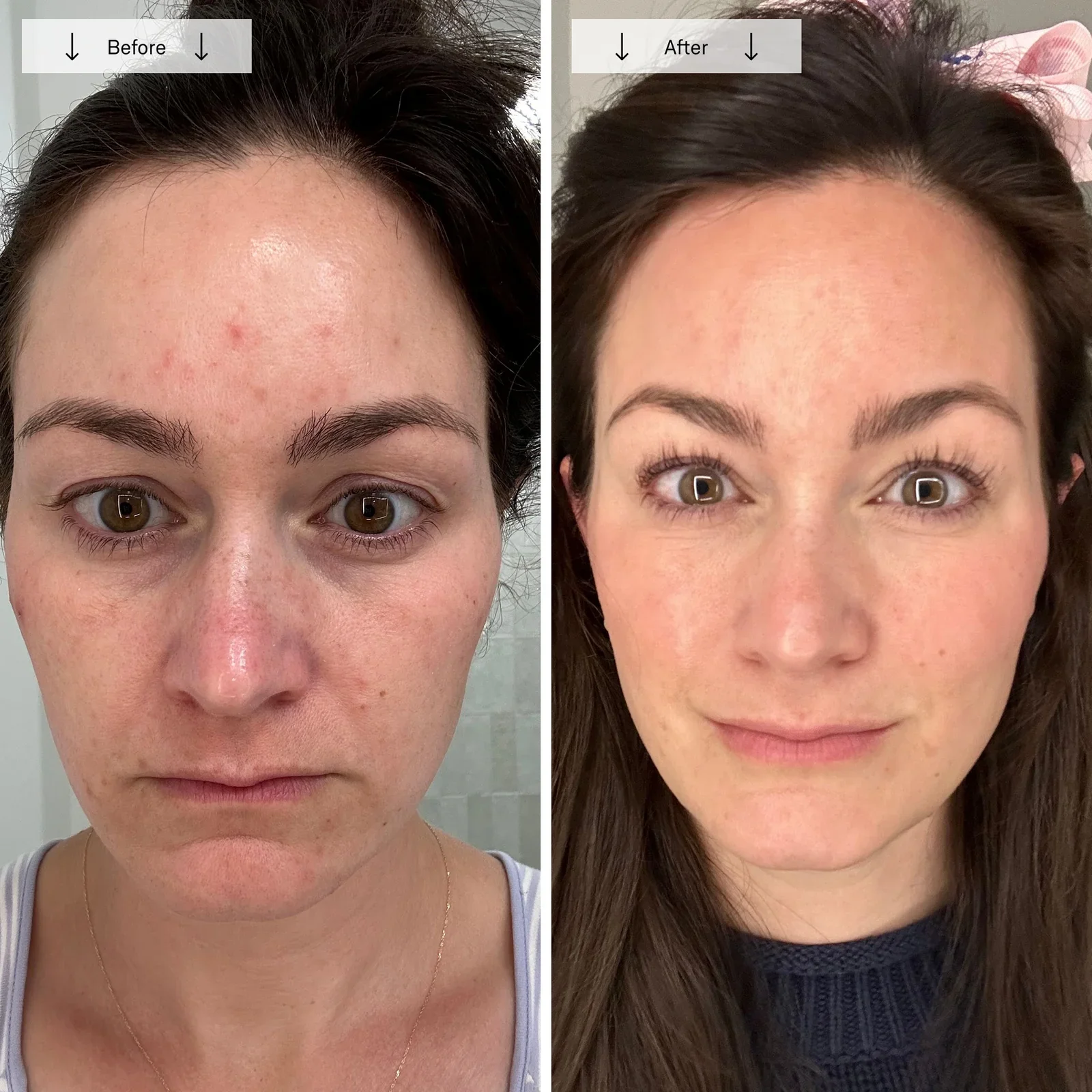 Contour_Face_PDP_Image_10_BA_1.webp