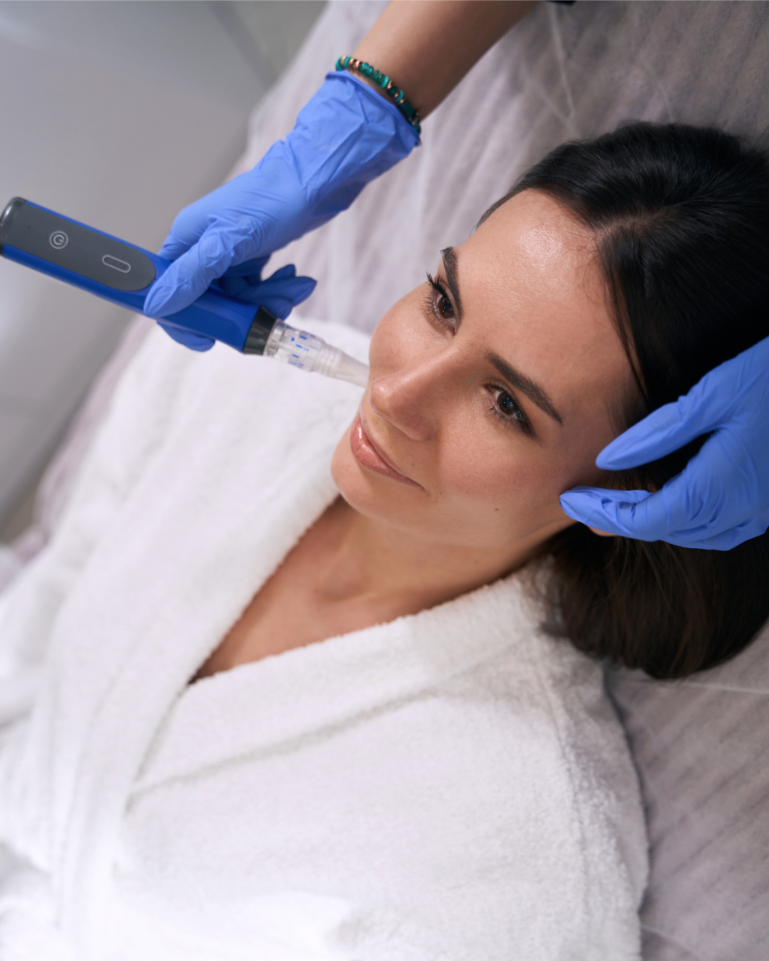 A woman is lying down while a healthcare professional administers a microneedling treatment using a SkinPen device.