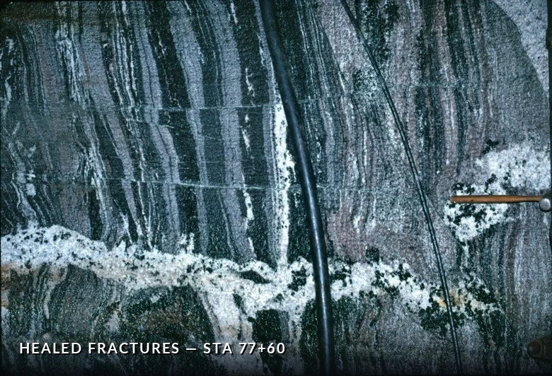 BKTL 7760 HealedFractures.jpg