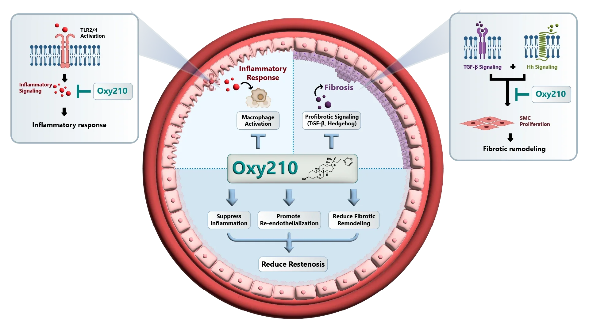Proposed mechanism of Oxy210 after balloon angioplasty, showing suppression of inflammatory and profibrotic signaling, promotion of re-endothelialization, and reduced restenosis.