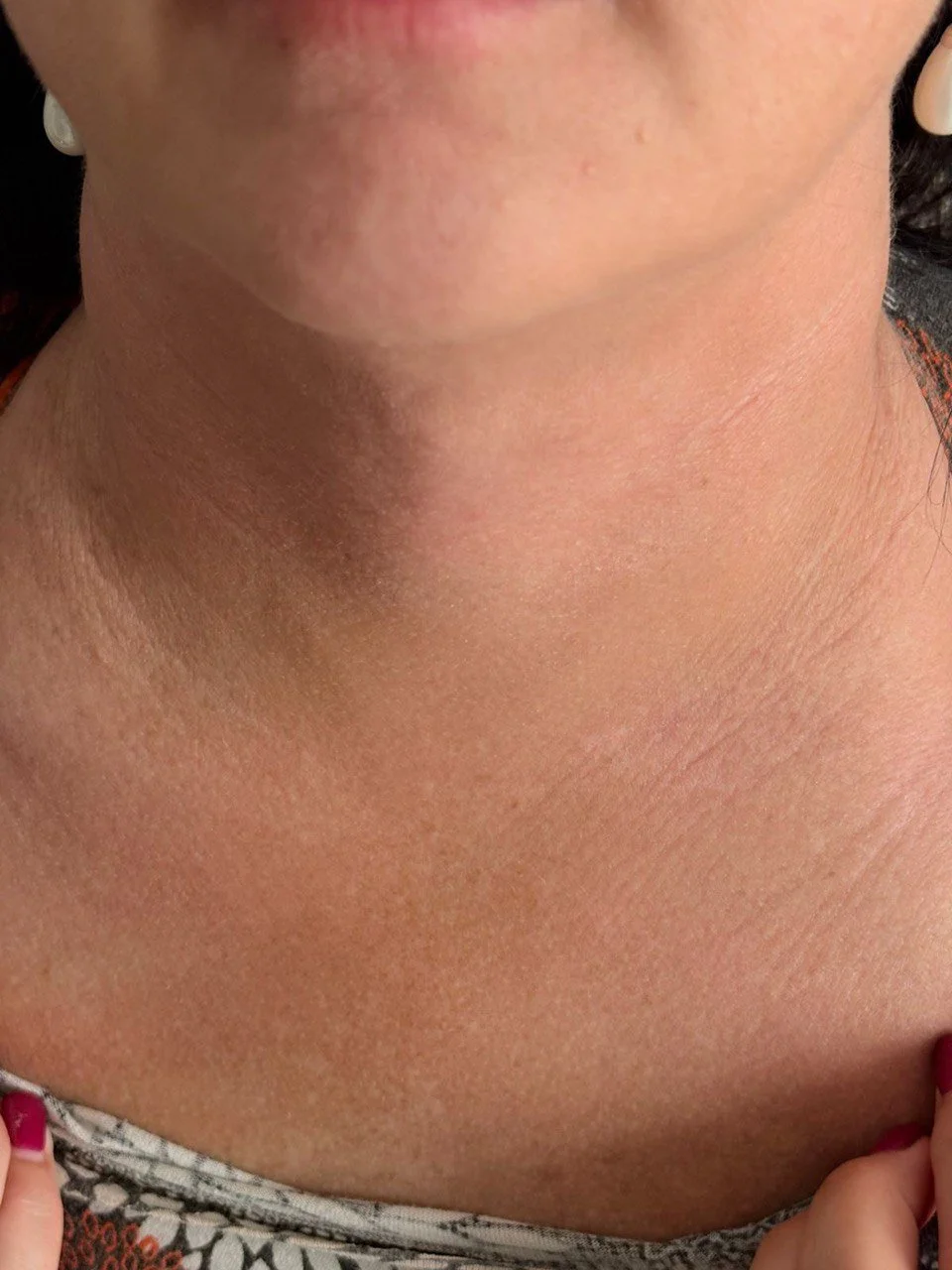 Close-up of a woman's neck, chin, and part of her hand with red nail polish, showing skin texture and makeup on the lips.