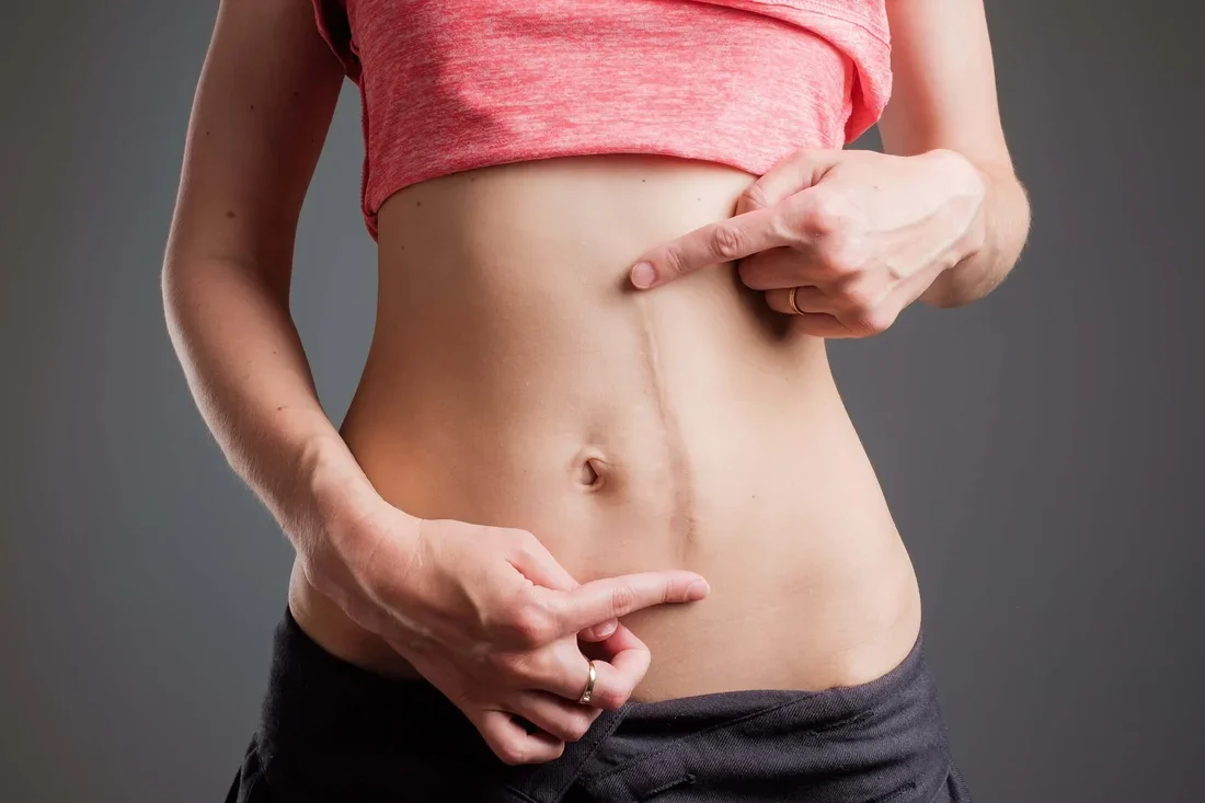 Break Free from Pain: Scar Tissue Therapy That Heals