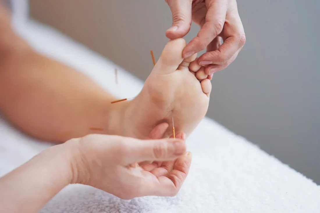 Break Free from Pain with Integrative Dry Needling