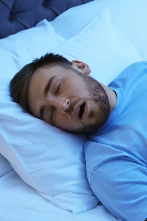 Young man sleeping on a pillow in bed, with mouth open and eyes closed.
