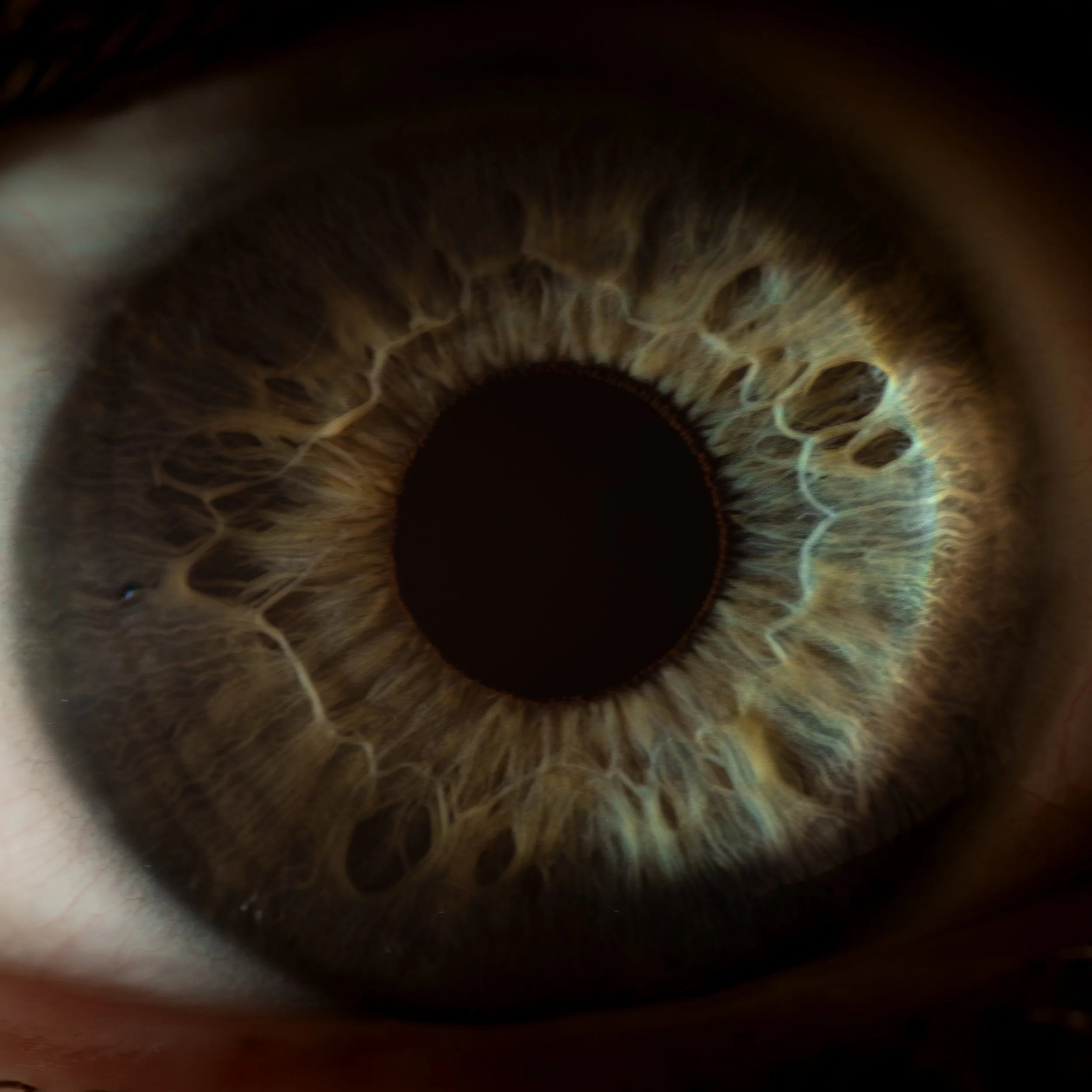 Irisfotografie