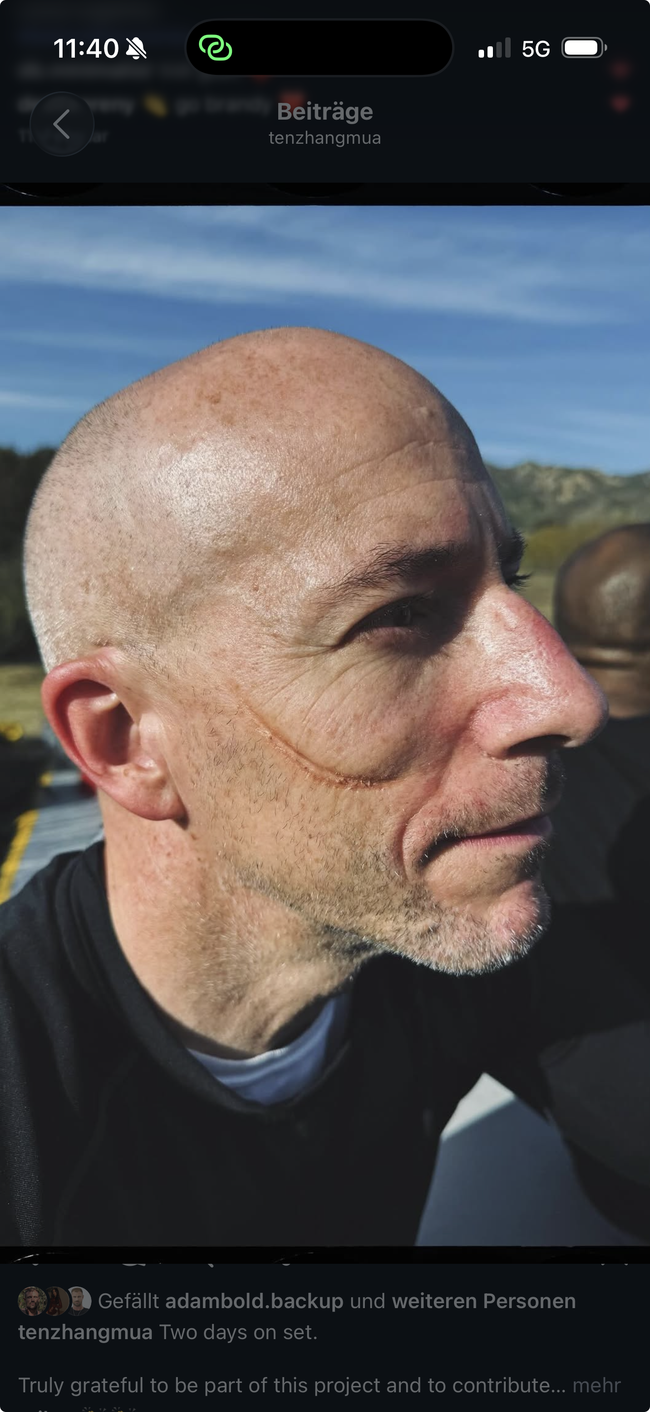 Close-up of a middle-aged man with a shaved head and visible scars on his face, outdoors on a sunny day with mountains in the background. TENZHANG MUA Switzerland