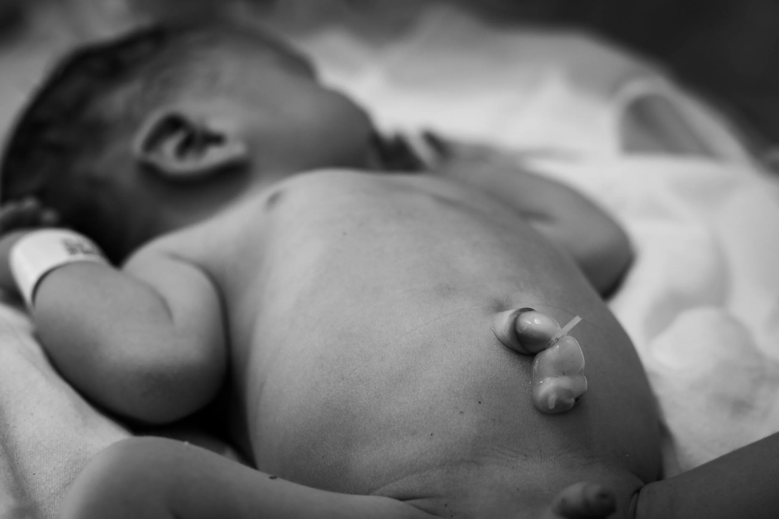 Close-up of a newborn baby lying on their back with a visual of a umbilical chord stump
