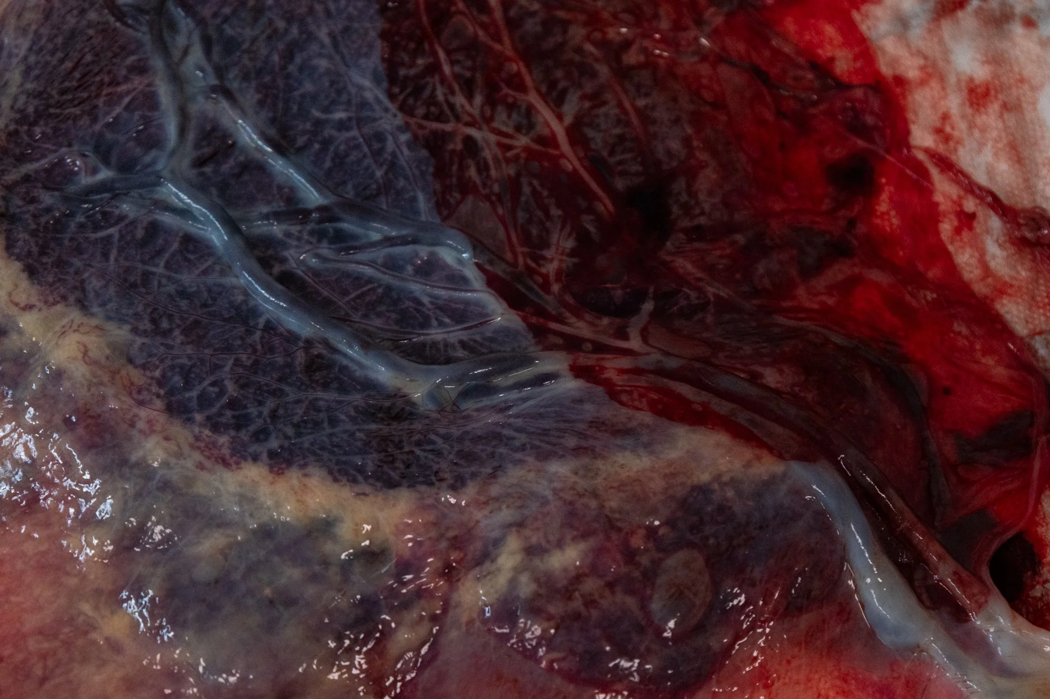Close-up view of biological tissue/placenta with dark and red areas, depicting internal organs after birth